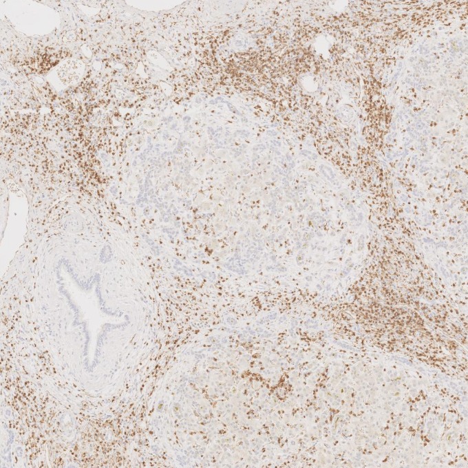 IHC staining of human liver using 60181-1-Ig
