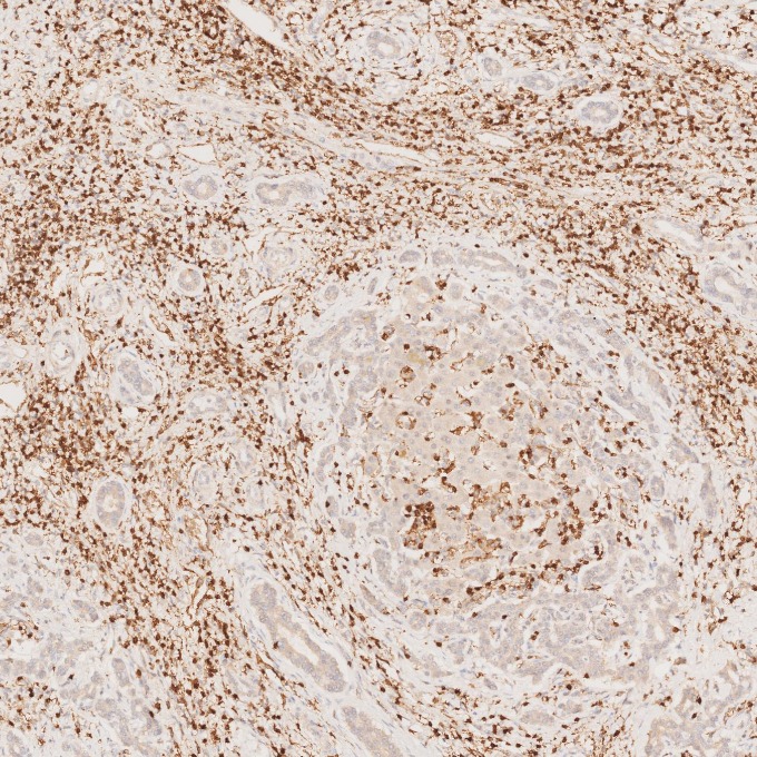 IHC staining of human liver using 60181-1-Ig