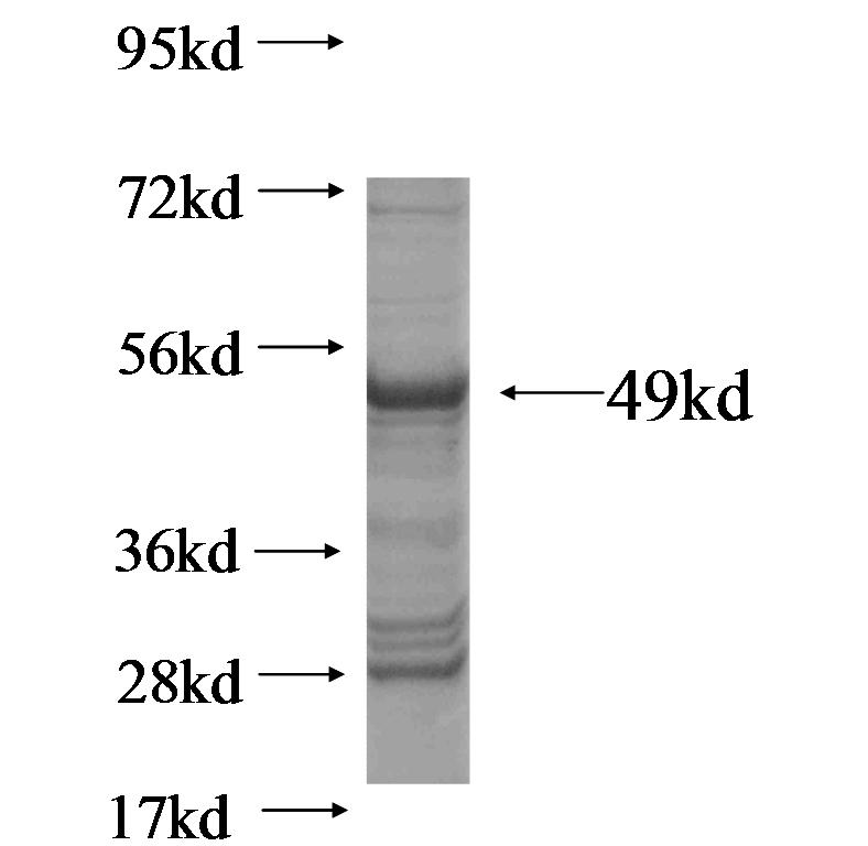 CD3E fusion protein Ag0889 SDS-PAGE CD3E fusion protein Ag0889 SDS-PAGE