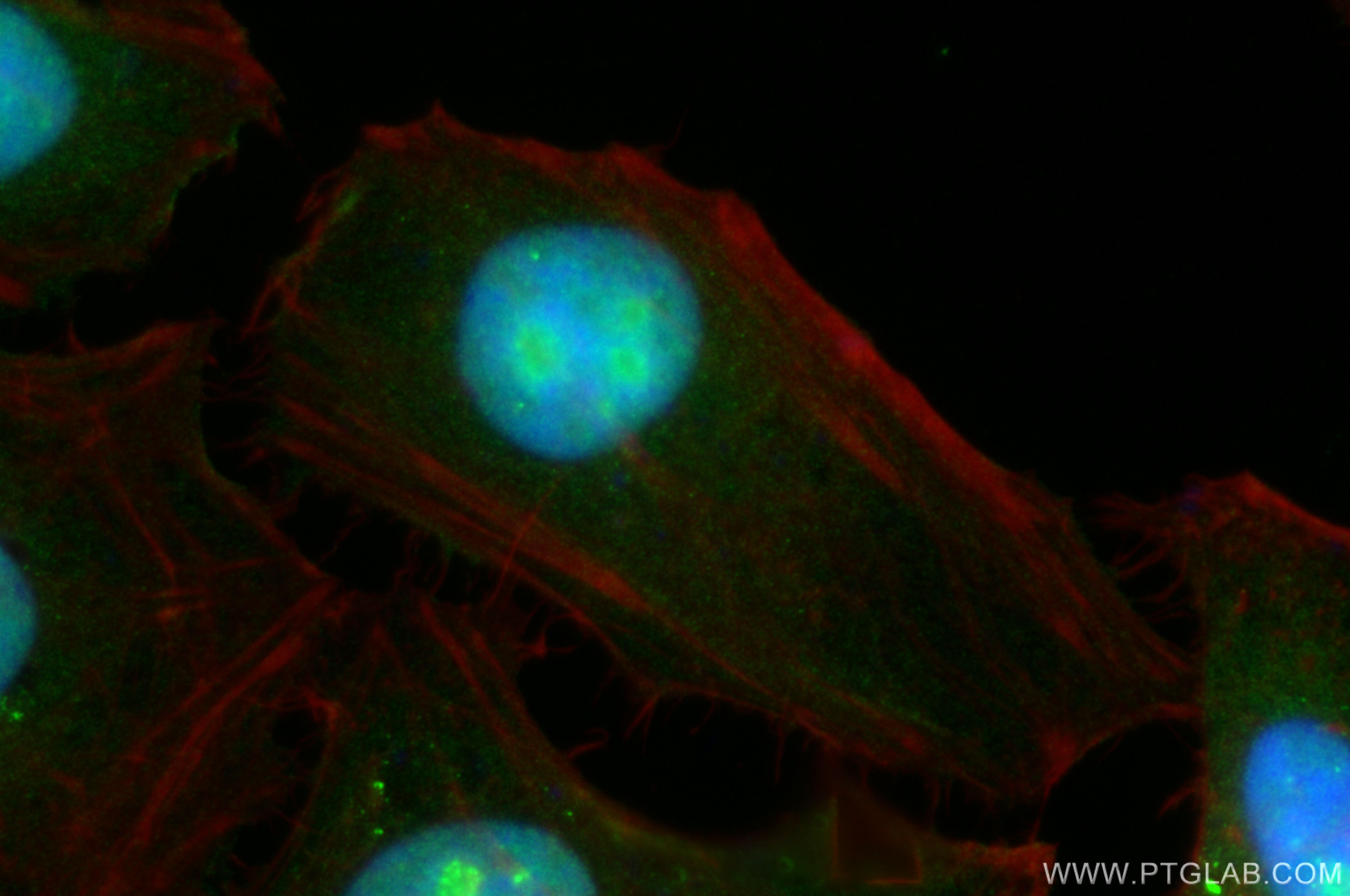 IF Staining of HeLa using 31014-1-AP (same clone as 31014-1-PBS)