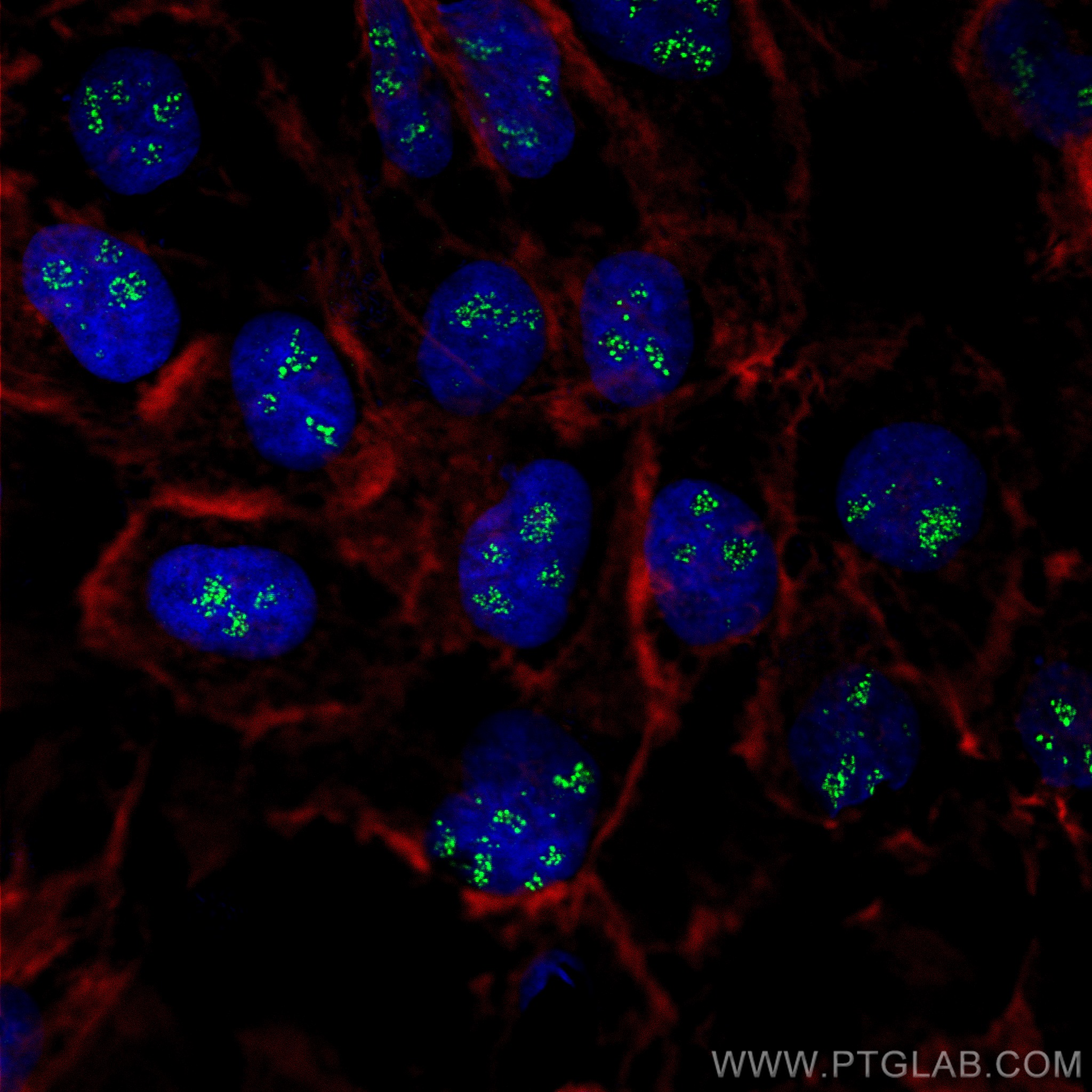 IF Staining of A431 using 31162-1-AP