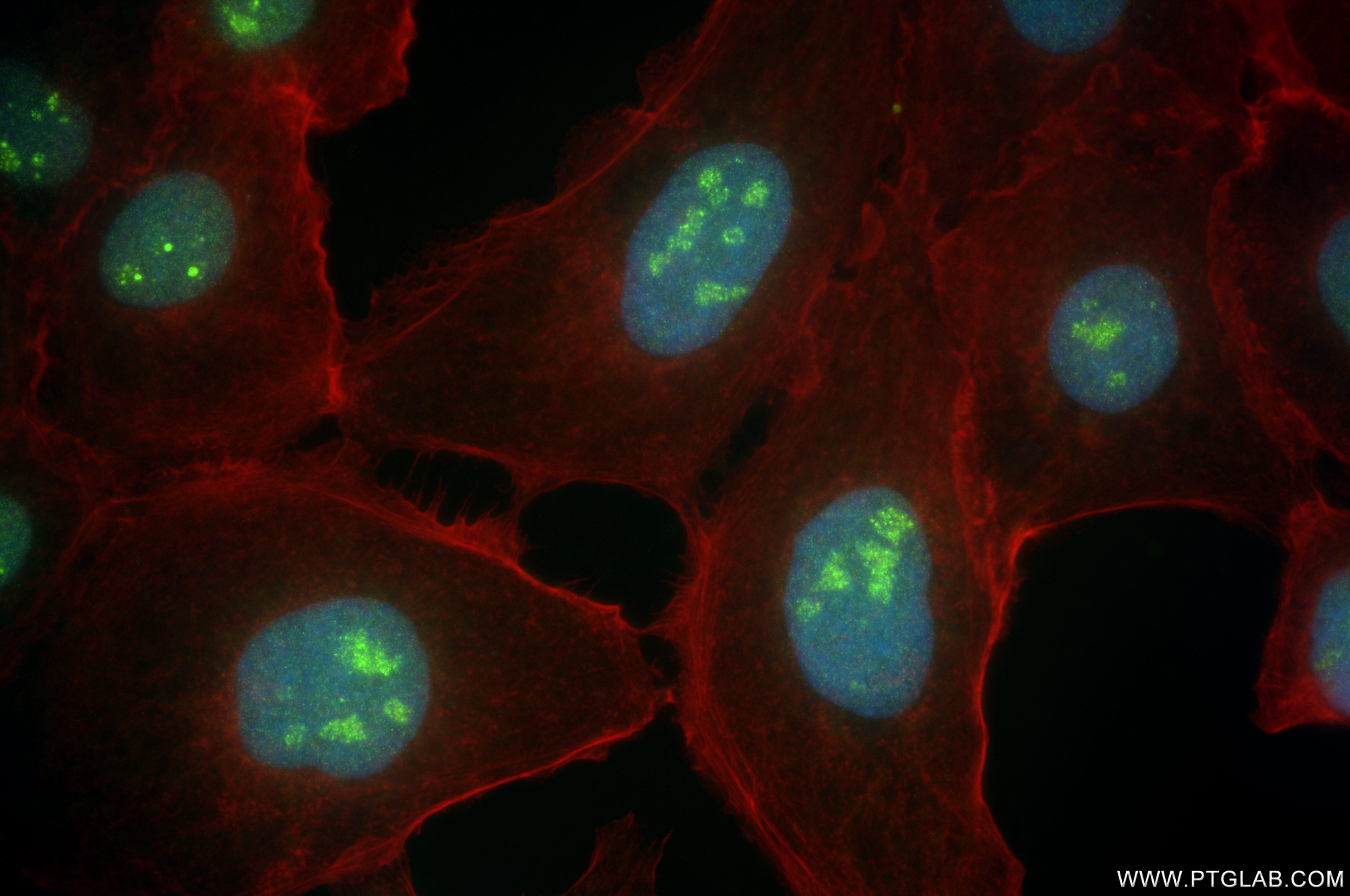 IF Staining of A431 using 84139-4-RR