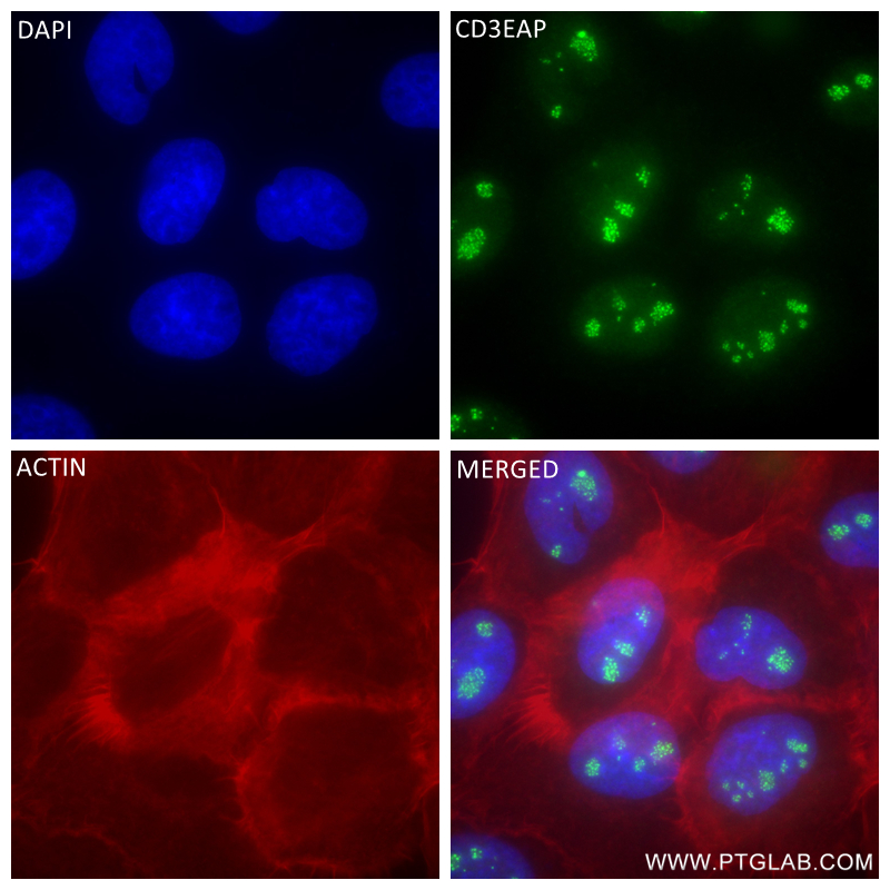 IF Staining of A431 using 84139-5-RR