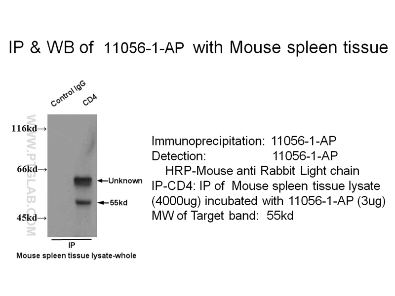 IP experiment of mouse spleen tissue using 11056-2-AP