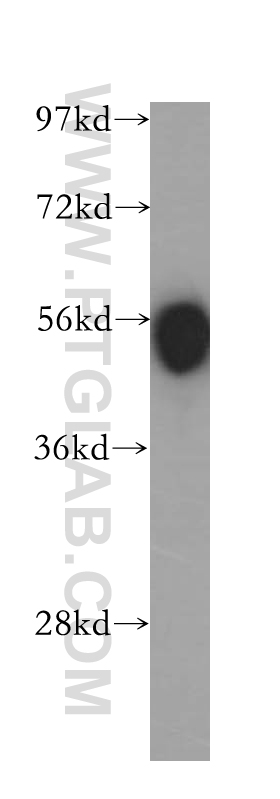 WB analysis of human spleen using 11056-2-AP