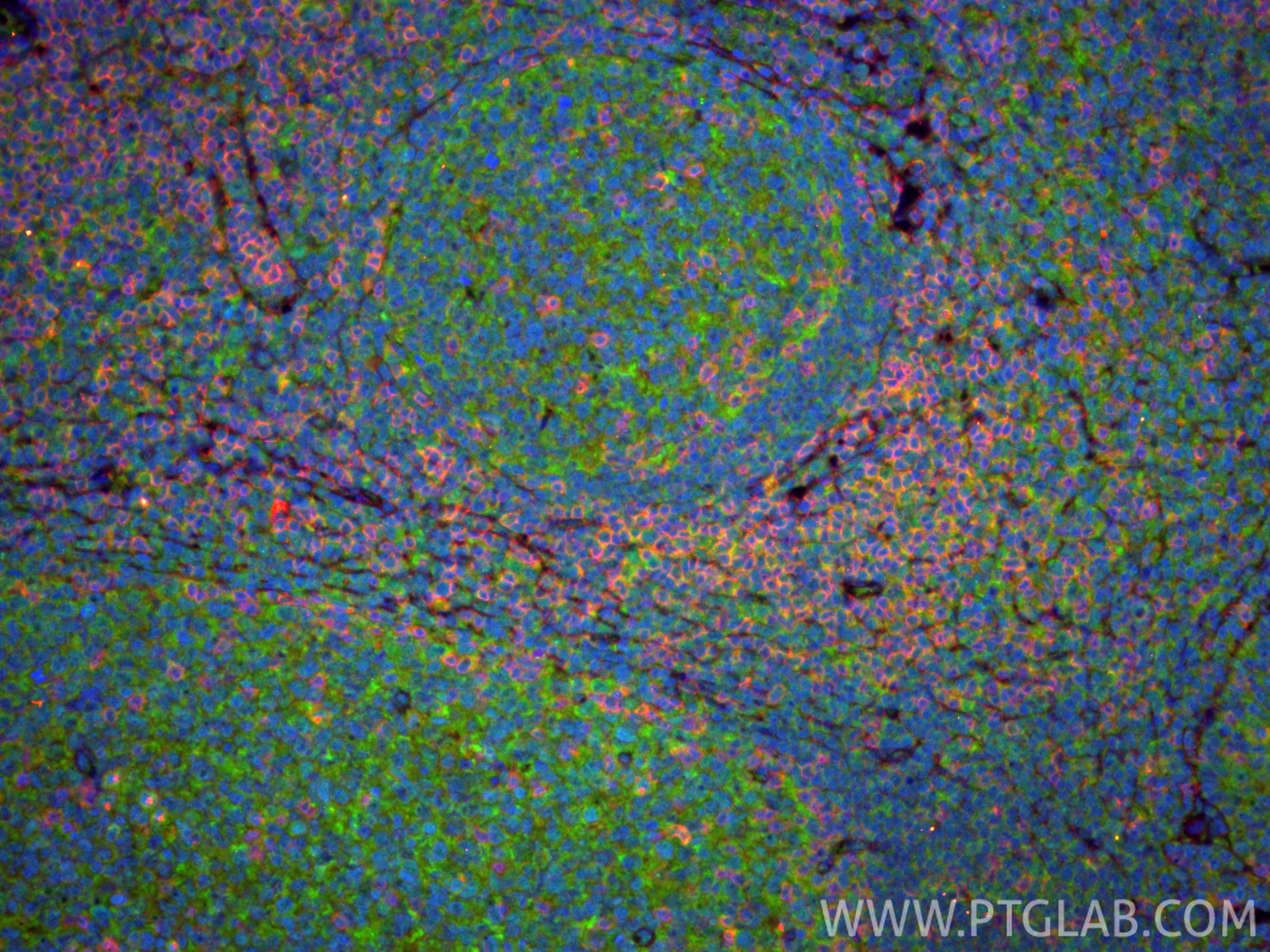 Immunofluorescent analysis of (4% PFA) fixed paraffin-embedded human tonsillitis tissue using CD4 antibody (19068-1-AP) at dilution of 1:400 and CoraLite®488-Conjugated Goat Anti-Rabbit IgG(H+L) (<a class='green' href='/productredirect?CatalogNo=SA00013-2' target='_blank'>SA00013-2</a>), CD3 antibody (<a class='green' href='/productredirect?CatalogNo=60181-1-Ig' target='_blank'>60181-1-Ig</a>, Clone: 3F3A1, red). Heat mediated antigen retrieval with Tris-EDTA buffer (pH 9.0). IF Staining of human tonsillitis using 19068-1-AP