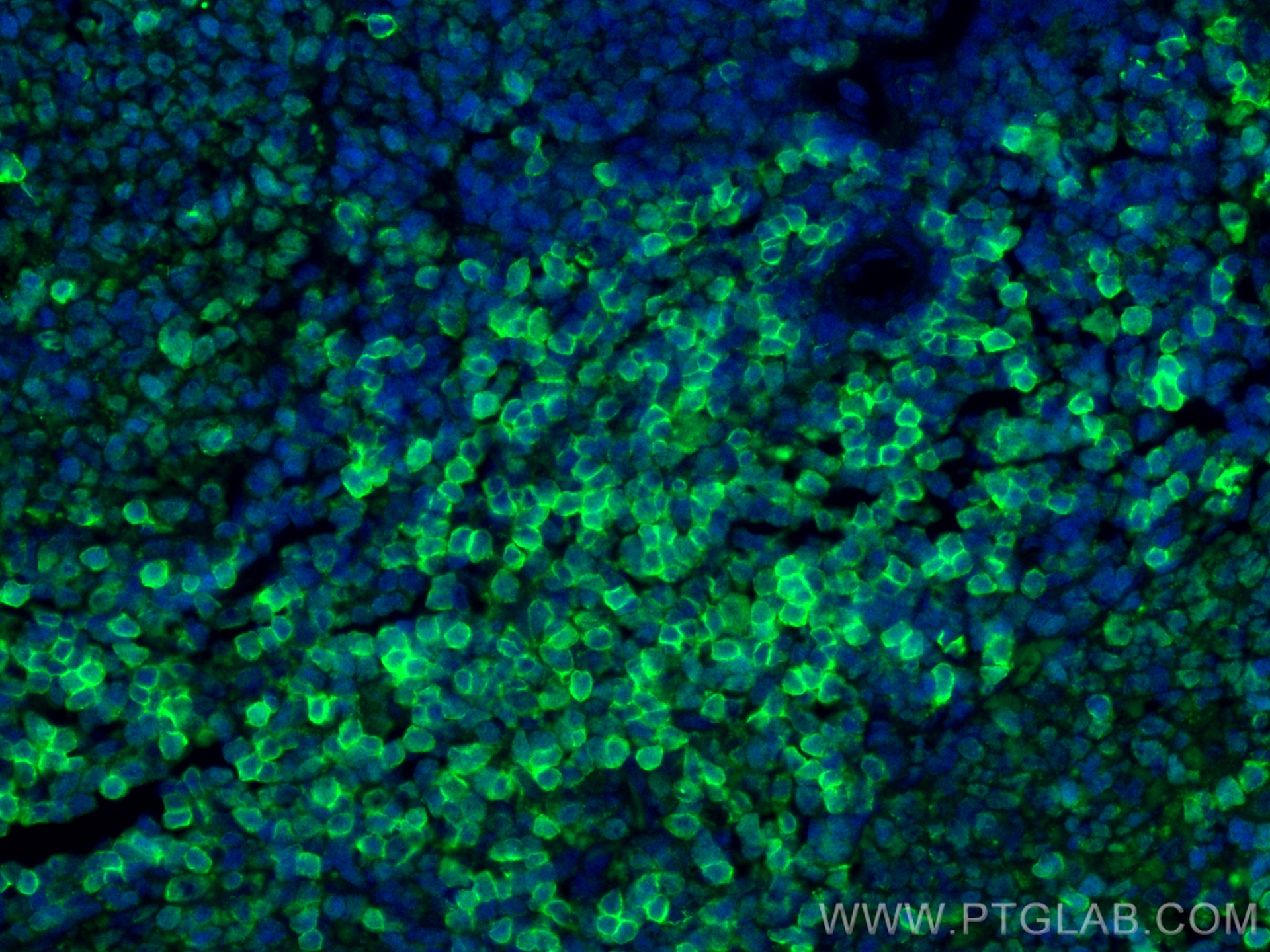 IF Staining of rat spleen using 32406-1-AP