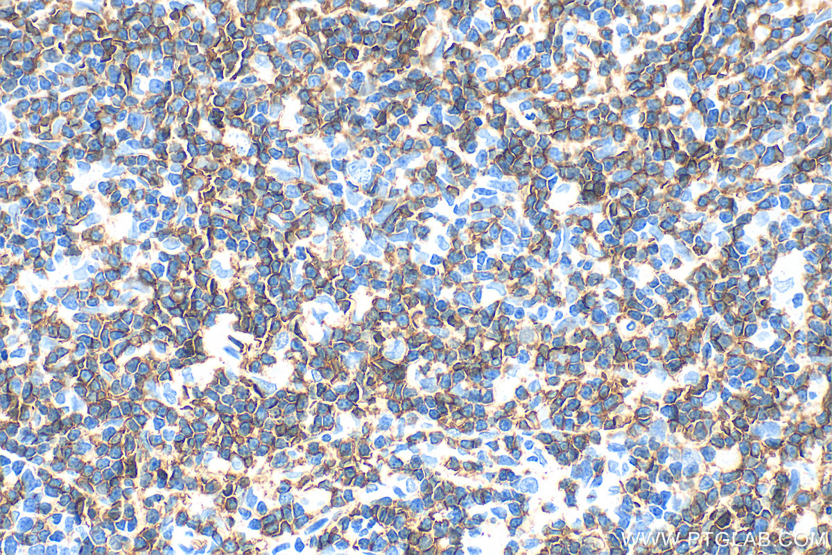 IHC staining of rat thymus using 32406-1-AP