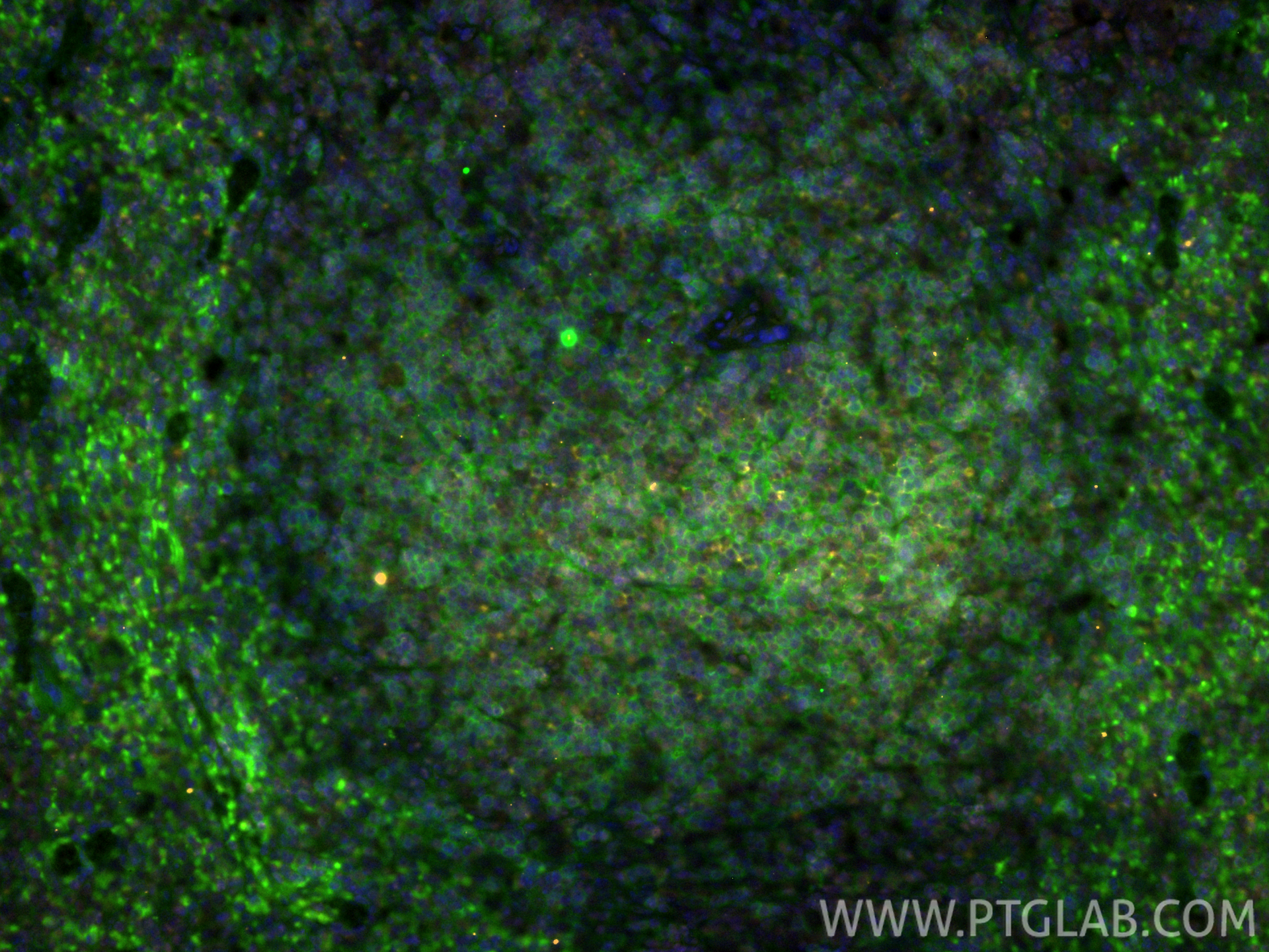 IF Staining of mouse spleen using 86300-3-RR IF Staining of mouse spleen using 86300-3-RR