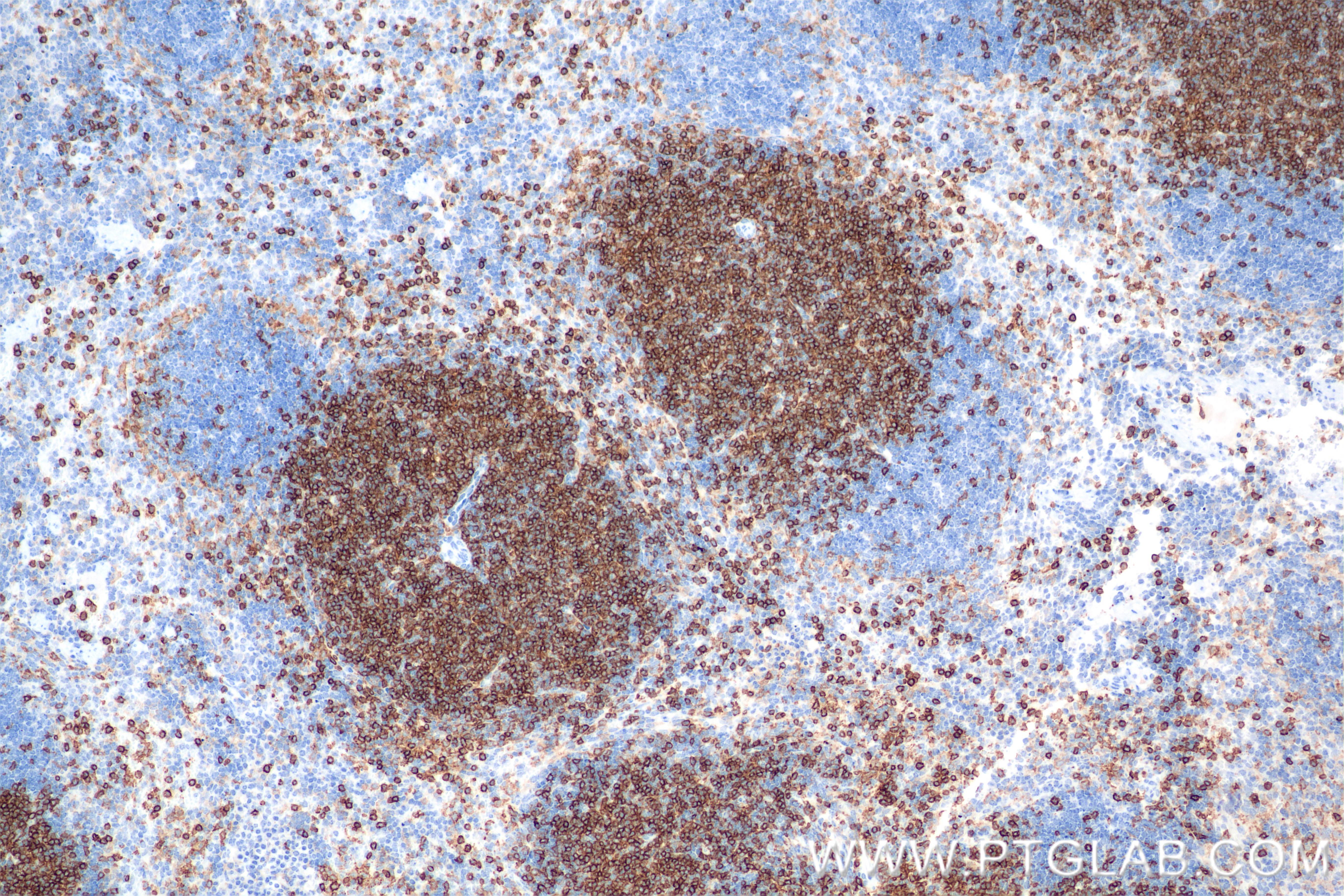 IHC staining of mouse spleen using 86300-3-RR