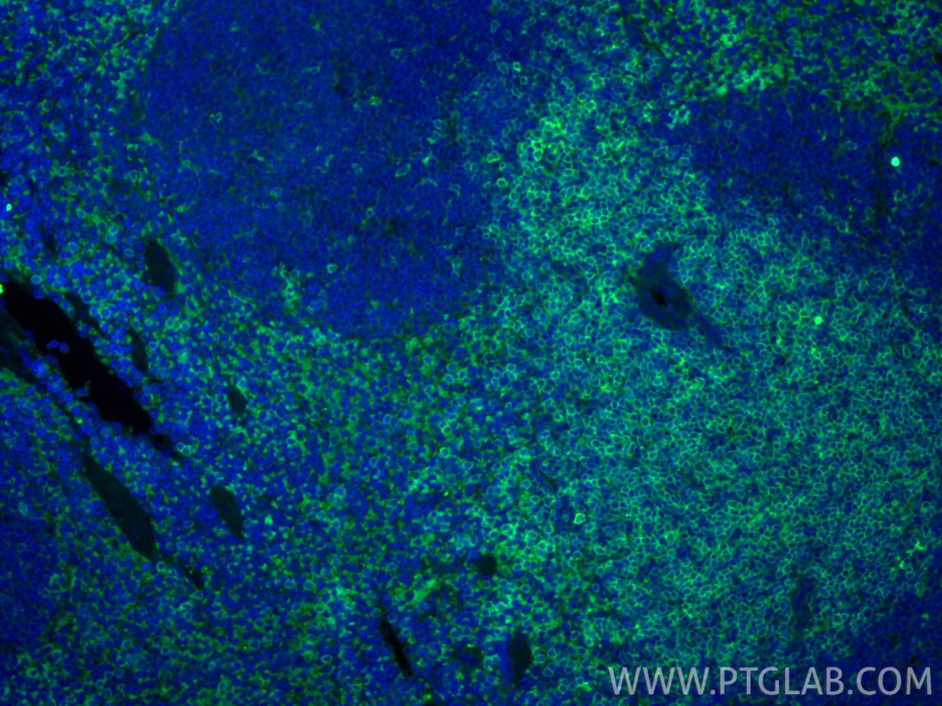 IF Staining of mouse spleen using CL488-86300-3