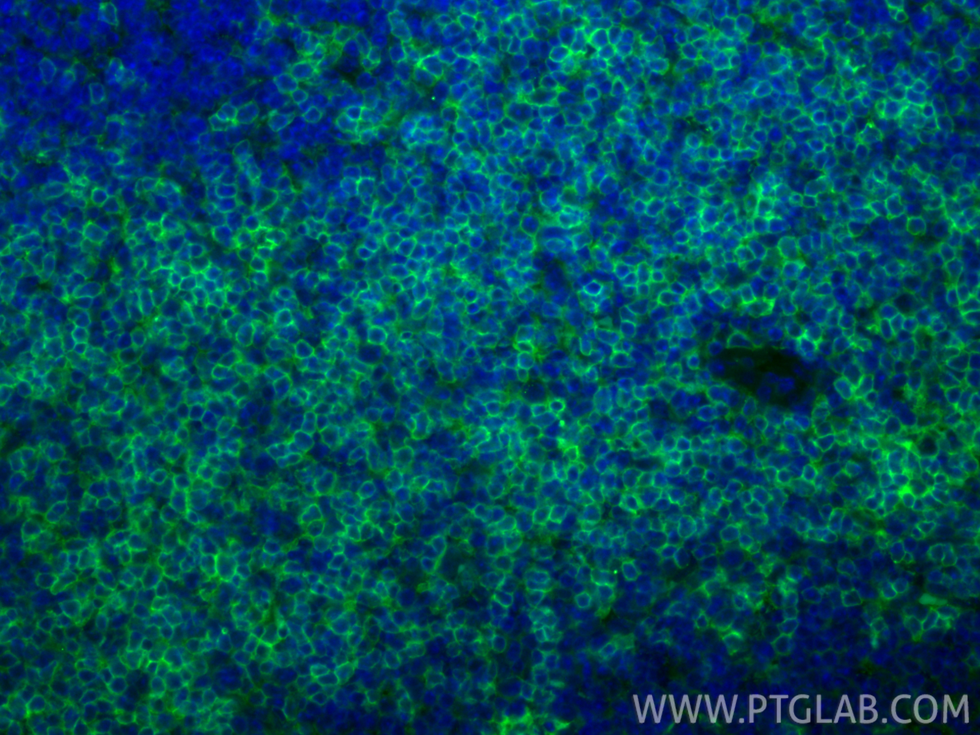 IF Staining of mouse spleen using CL488-86300-3