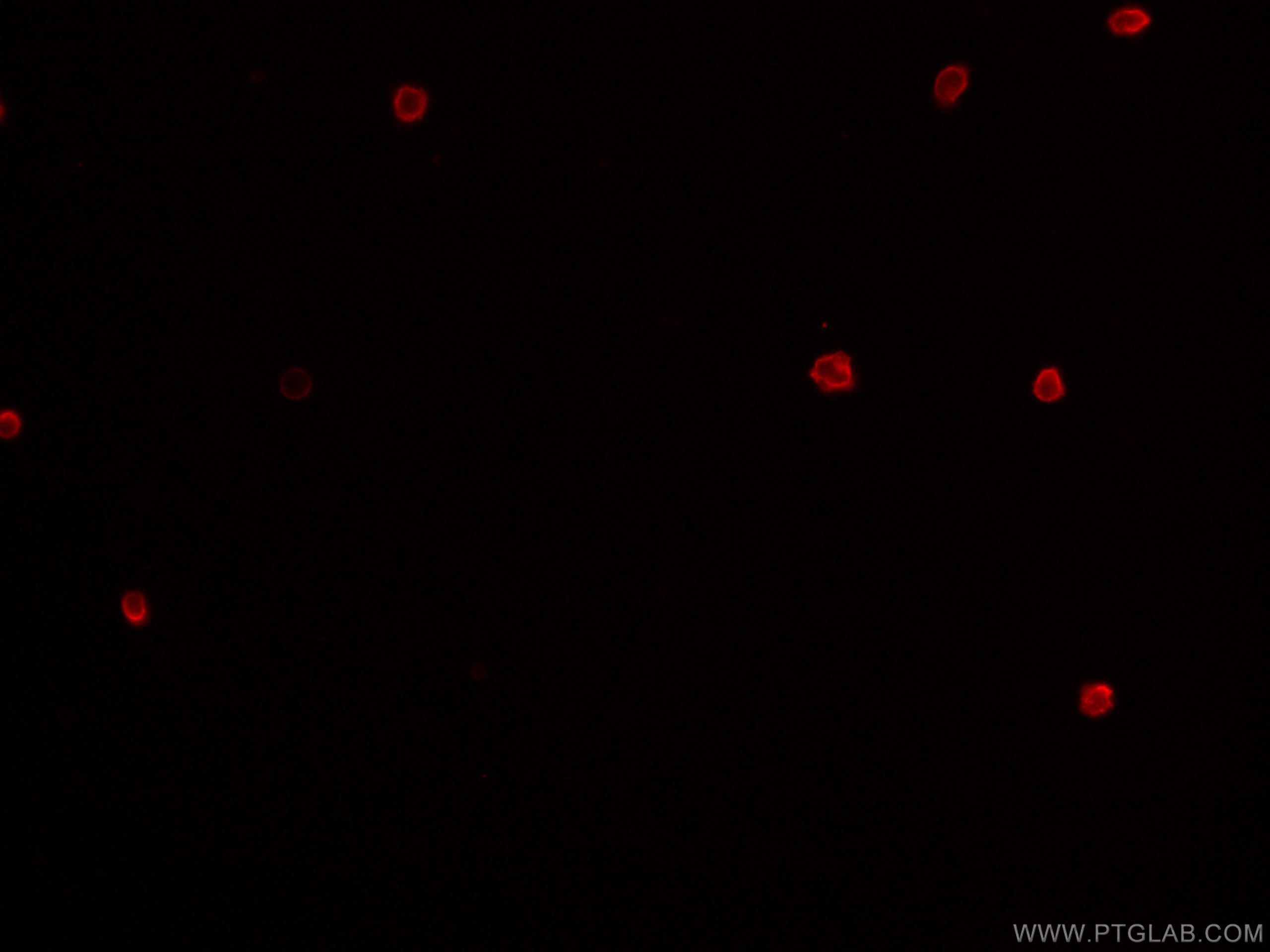 IF Staining of mouse splenocytes using CL647-65141