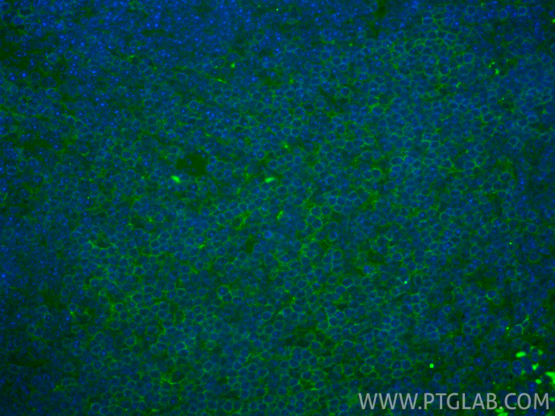IF Staining of mouse spleen using FITC-86300-3 IF Staining of mouse spleen using FITC-86300-3