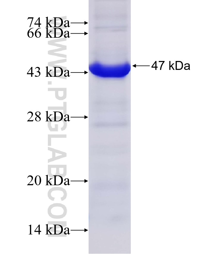 CD4 fusion protein Ag32018 SDS-PAGE CD4 fusion protein Ag32018 SDS-PAGE