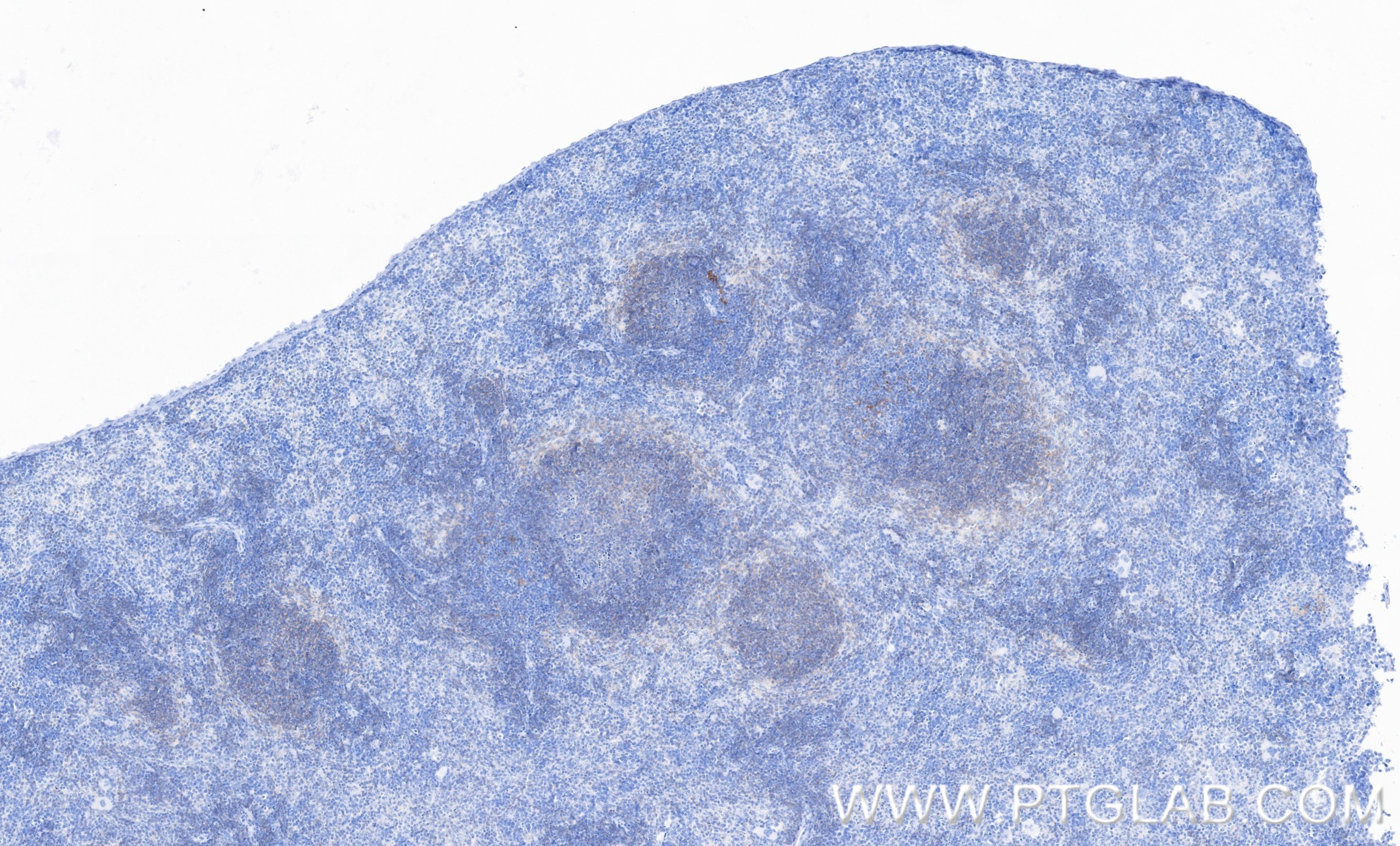 IHC staining of mouse spleen using 98122-1-RR IHC staining of mouse spleen using 98122-1-RR