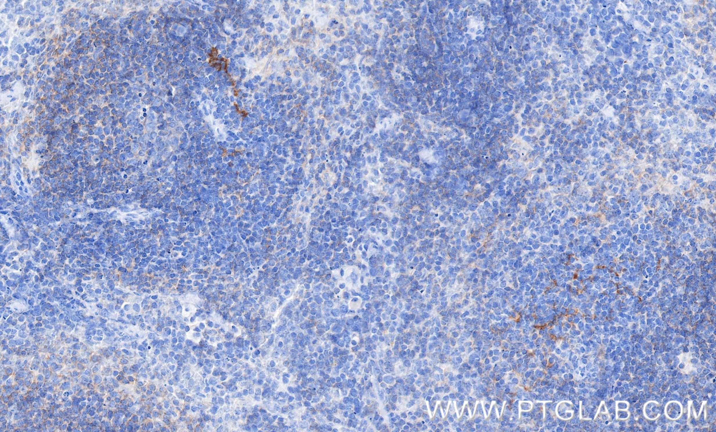 IHC staining of mouse spleen using 98122-1-RR IHC staining of mouse spleen using 98122-1-RR
