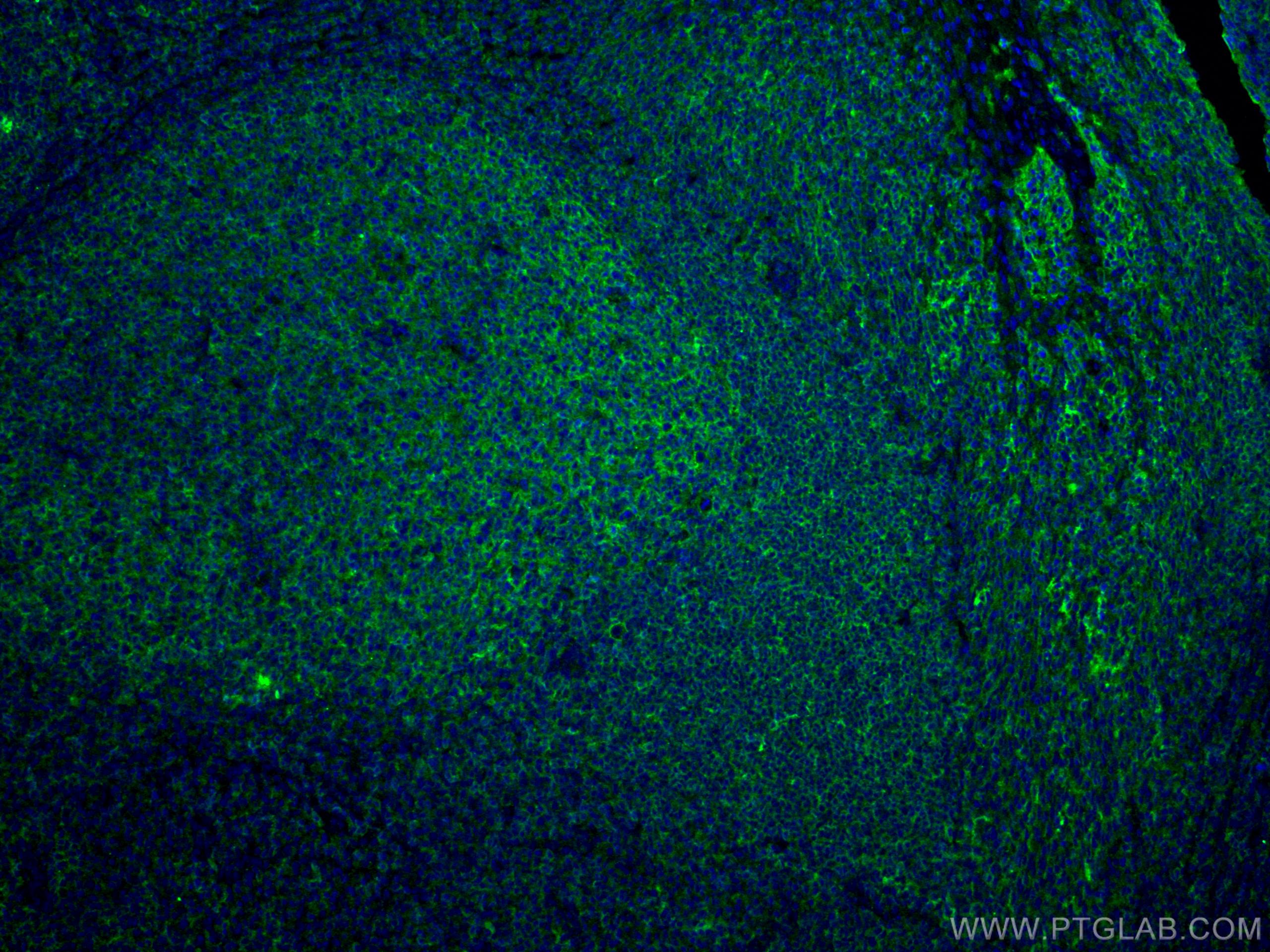 IF Staining of human tonsillitis using CL488-66965