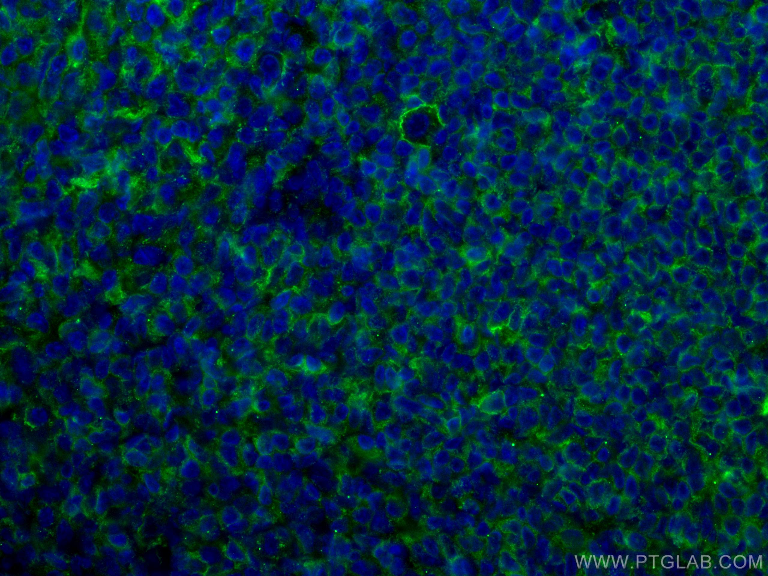 IF Staining of human tonsillitis using CL488-66965