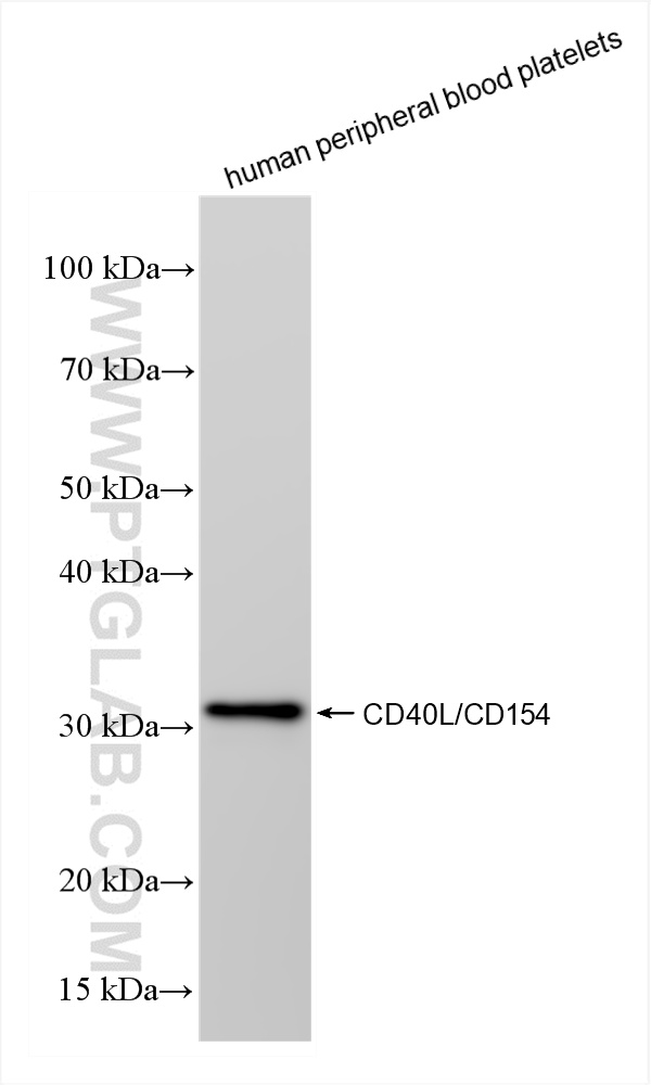 WB analysis of human peripheral blood platelets using 85209-4-RR (same clone as 85209-4-PBS)