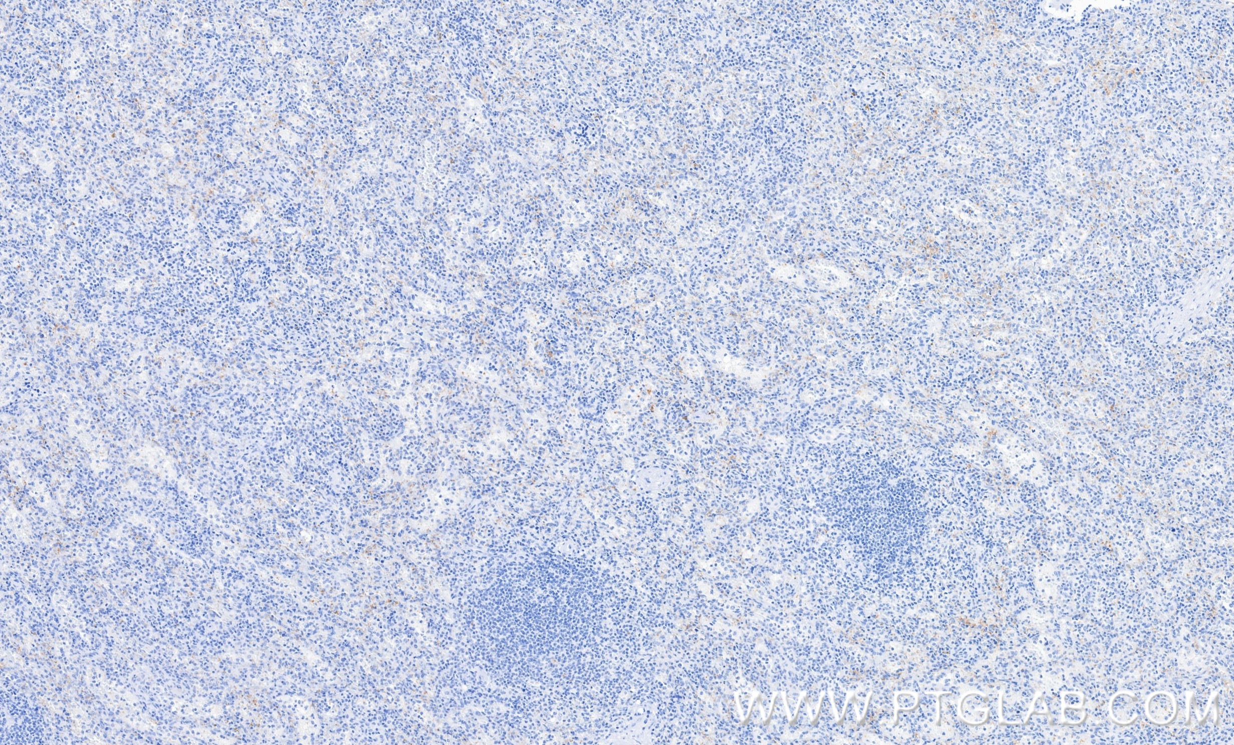IHC staining of human spleen using 87447-4-RR (same clone as 87447-4-PBS) IHC staining of human spleen using 87447-4-RR (same clone as 87447-4-PBS)