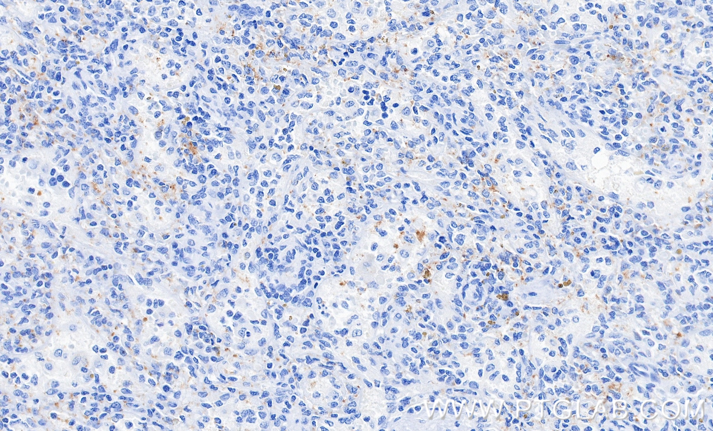 IHC staining of human spleen using 87447-4-RR (same clone as 87447-4-PBS) IHC staining of human spleen using 87447-4-RR (same clone as 87447-4-PBS)