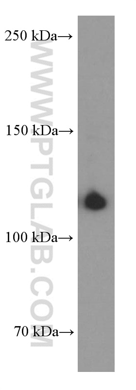 CD41/Integrin Alpha 2B