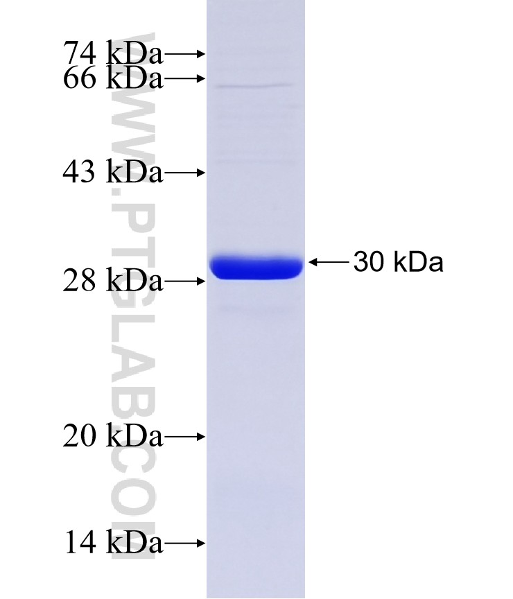 CD41/Integrin alpha 2b fusion protein Ag19469 SDS-PAGE