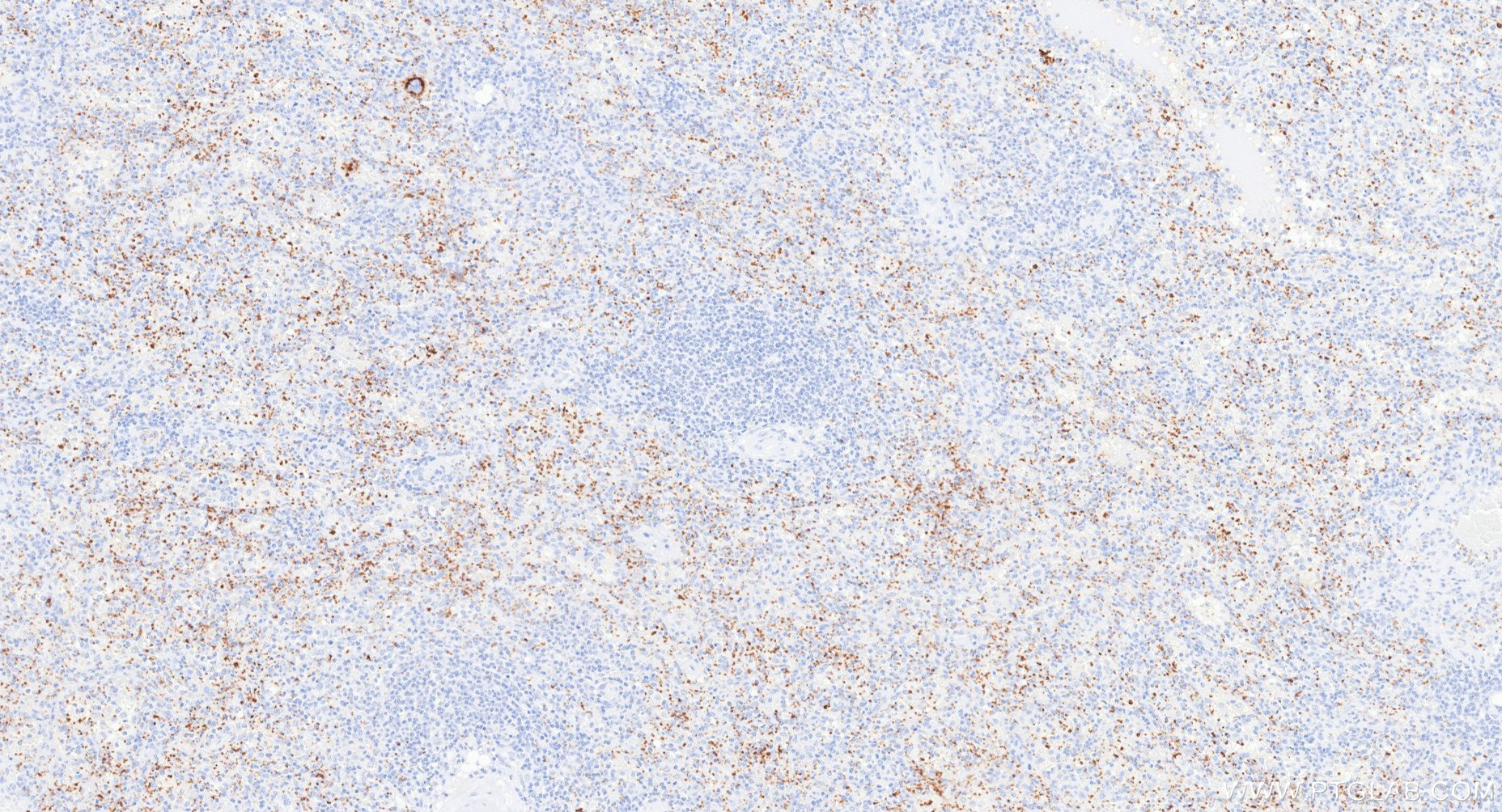 IHC staining of human spleen using 87285-3-RR (same clone as 87285-3-PBS) IHC staining of human spleen using 87285-3-RR (same clone as 87285-3-PBS)