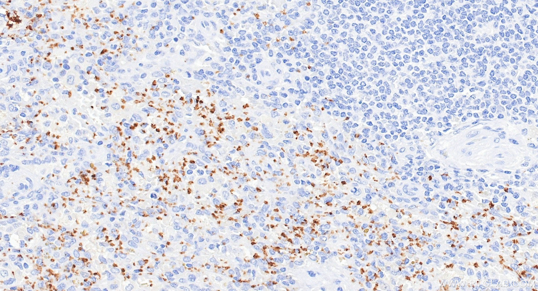 IHC staining of human spleen using 87285-3-RR (same clone as 87285-3-PBS) IHC staining of human spleen using 87285-3-RR (same clone as 87285-3-PBS)