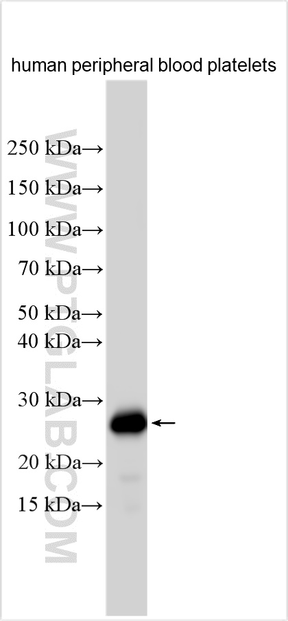 WB analysis using 32462-1-AP