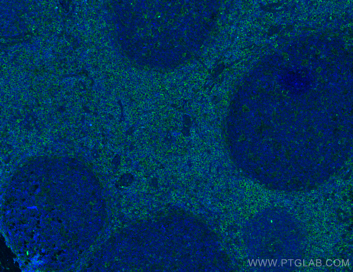 IF Staining of human tonsillitis using 66224-1-Ig (same clone as 66224-1-PBS)