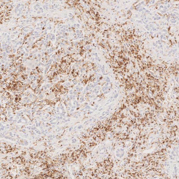 IHC staining of human liver using 66224-1-Ig
