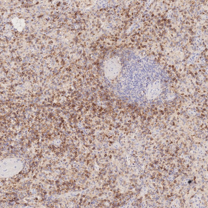 IHC staining of human spleen using 66224-1-Ig