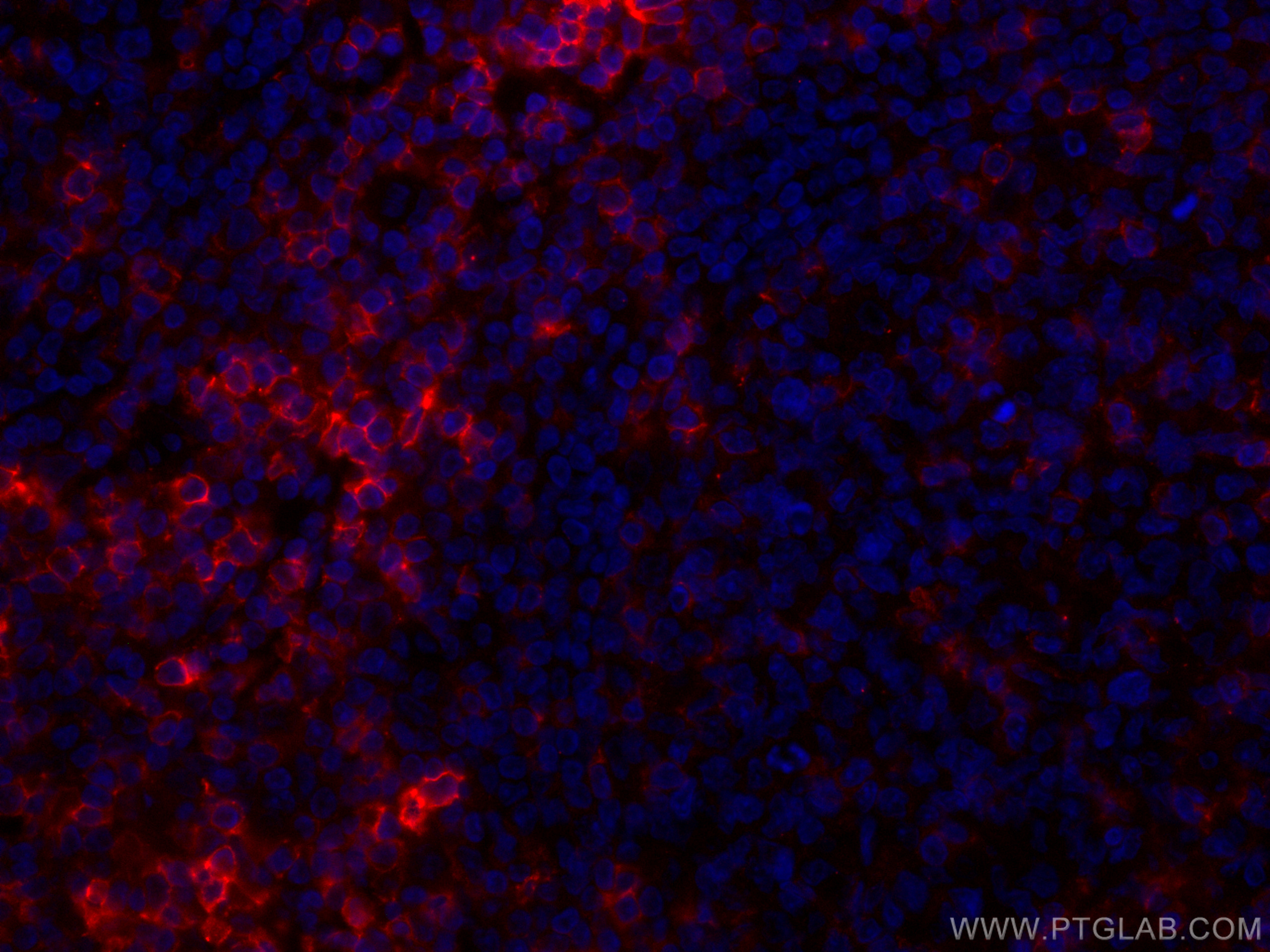 IF Staining of human tonsillitis using CL594-66224