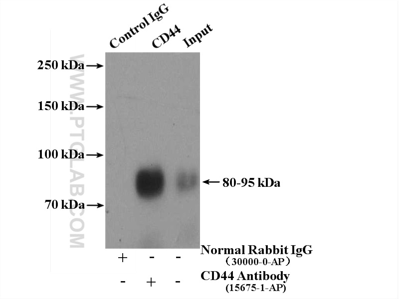 IP experiment of HeLa using 15675-1-AP