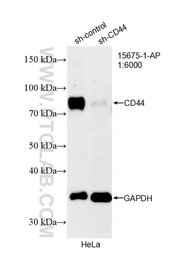 WB analysis of HeLa using 15675-1-AP WB analysis of HeLa using 15675-1-AP