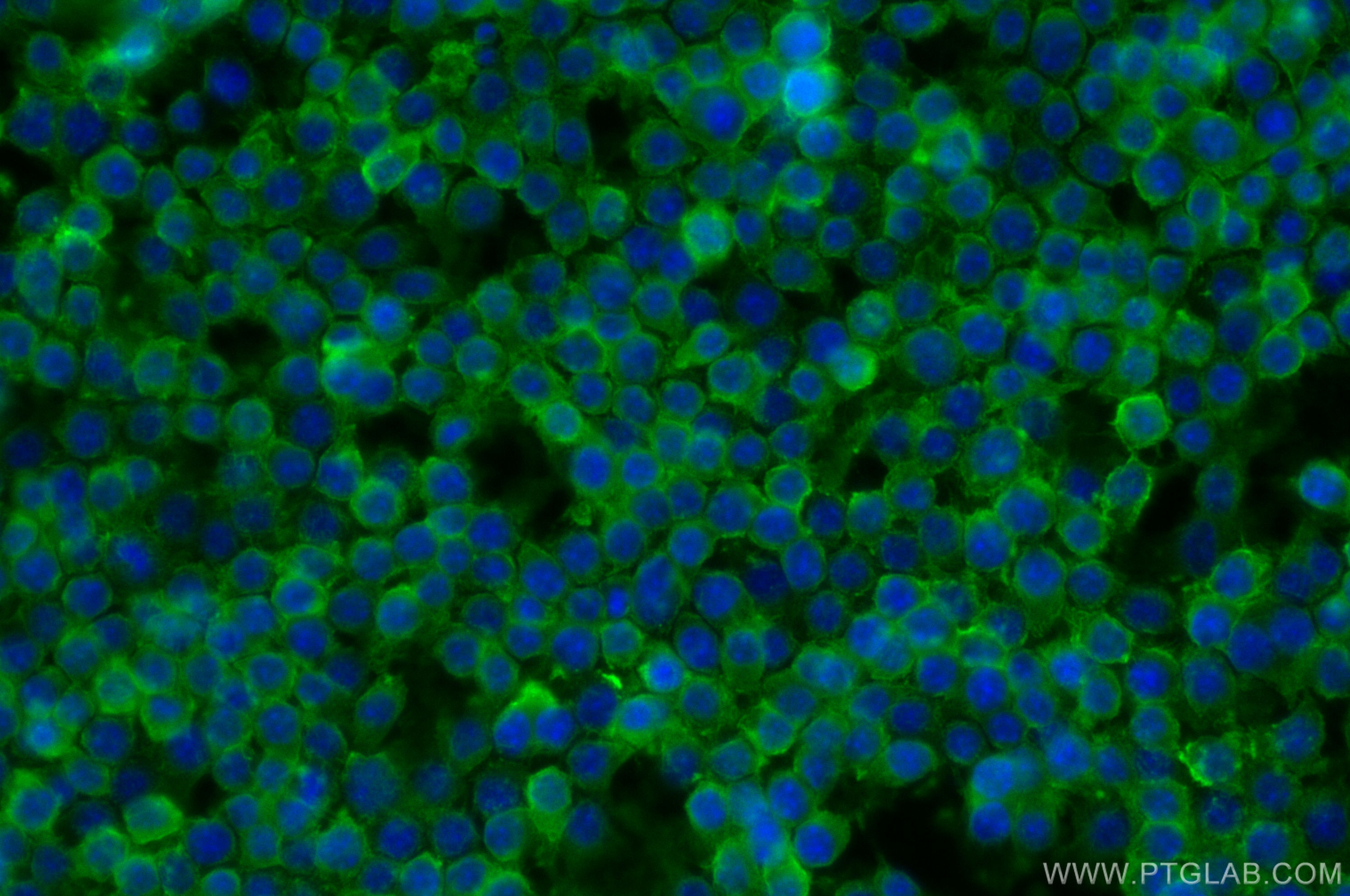 IF Staining of RAW 264.7 using 30854-1-AP