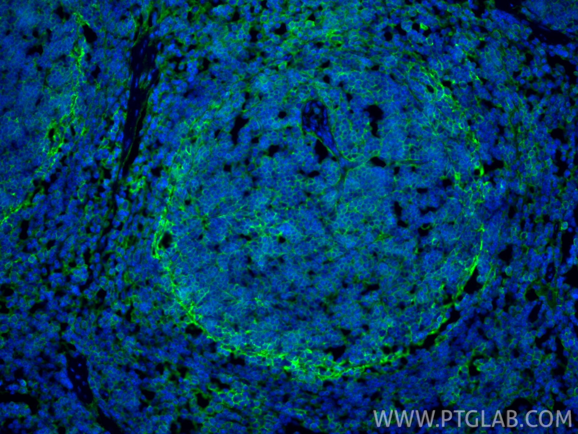 IF Staining of mouse spleen using 30854-1-AP IF Staining of mouse spleen using 30854-1-AP