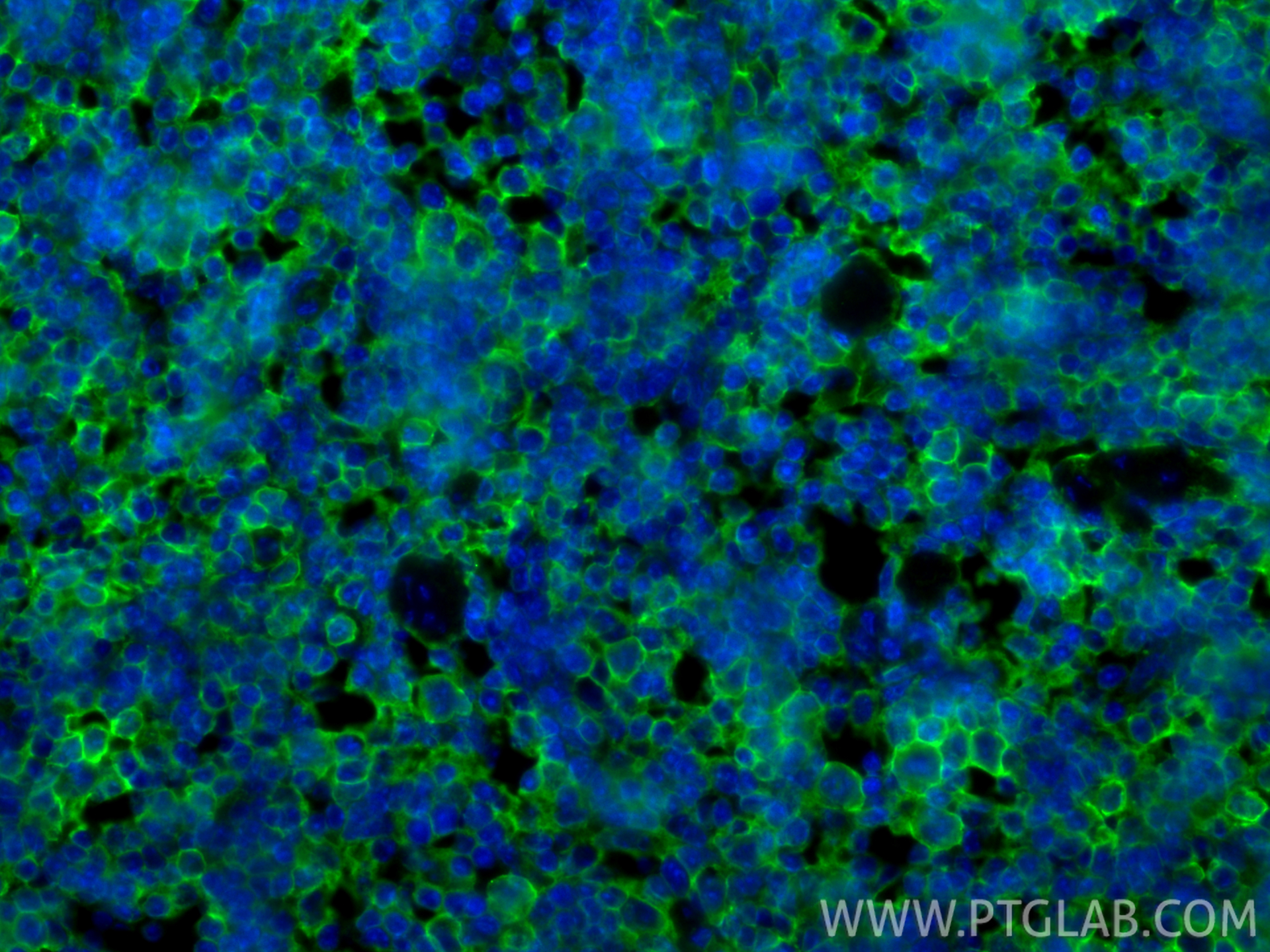 IF Staining of mouse spleen using 30854-1-AP IF Staining of mouse spleen using 30854-1-AP