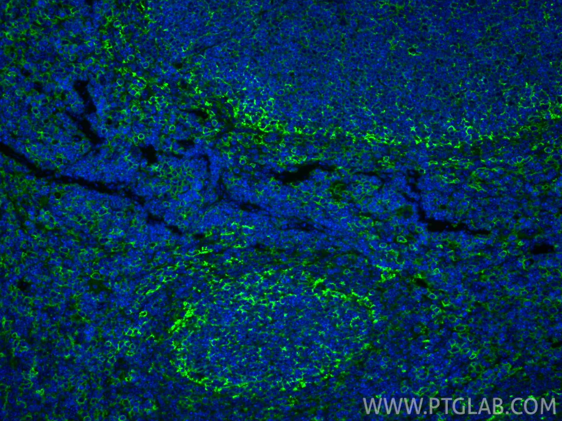 IF Staining of mouse spleen using 30854-1-AP IF Staining of mouse spleen using 30854-1-AP