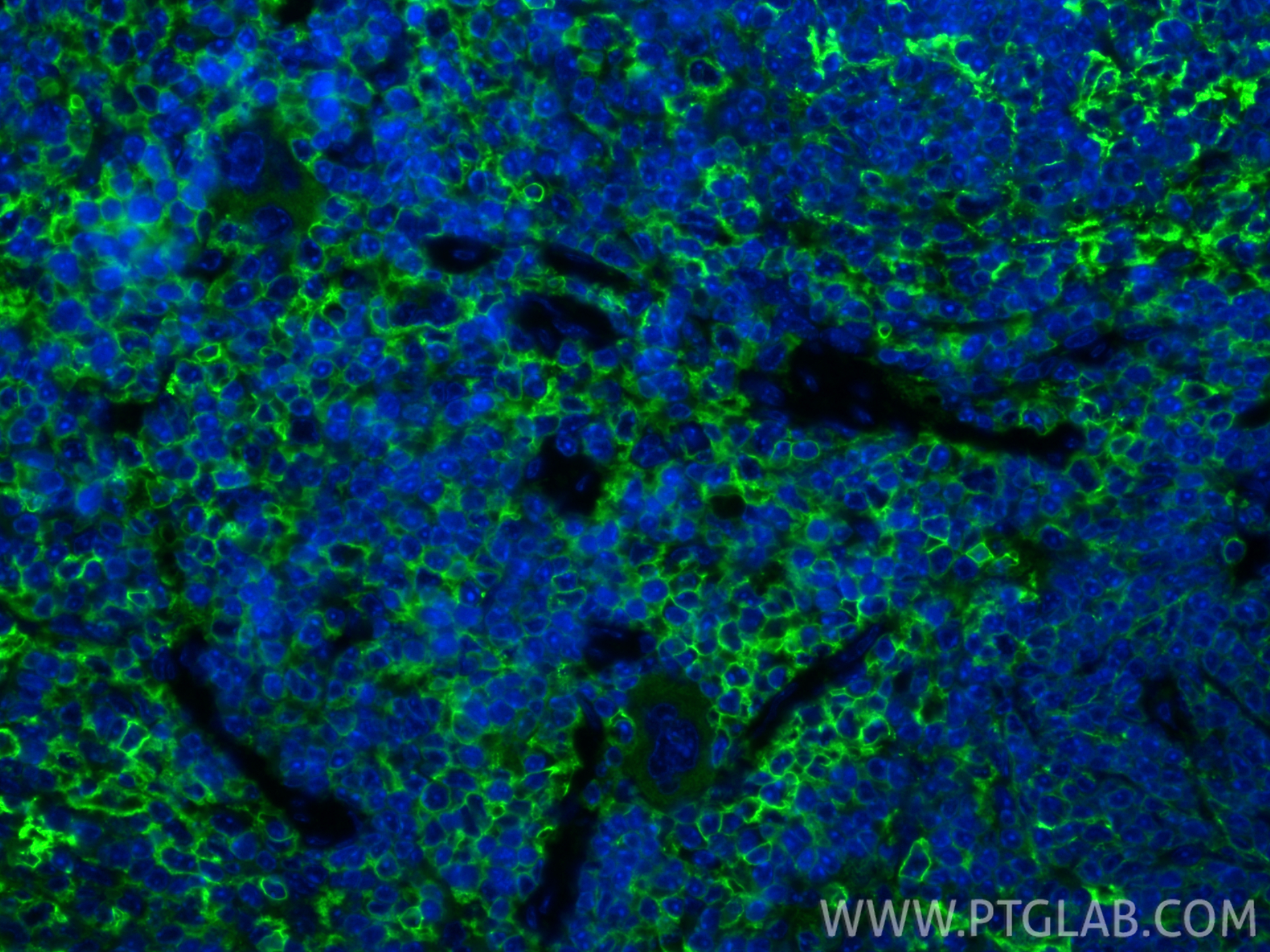 IF Staining of mouse spleen using 30854-1-AP IF Staining of mouse spleen using 30854-1-AP