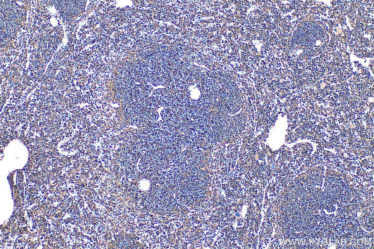IHC staining of mouse spleen using 30854-1-AP