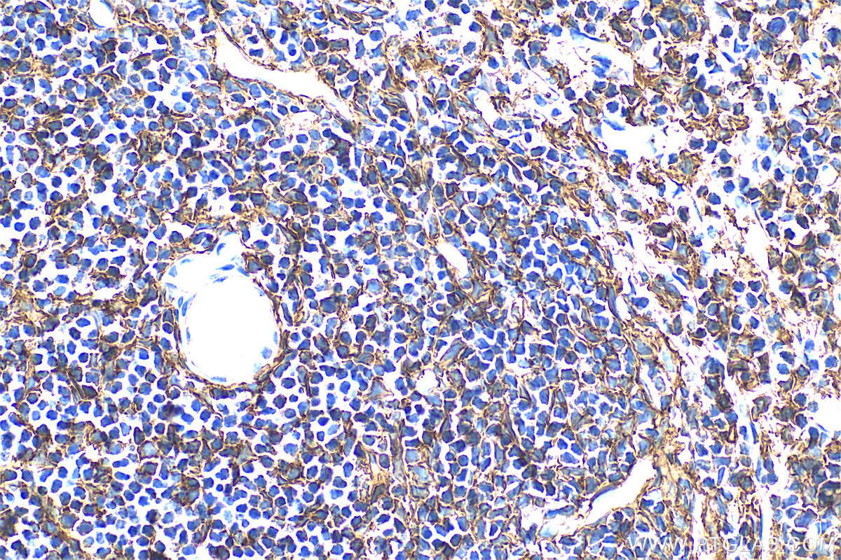IHC staining of mouse spleen using 30854-1-AP