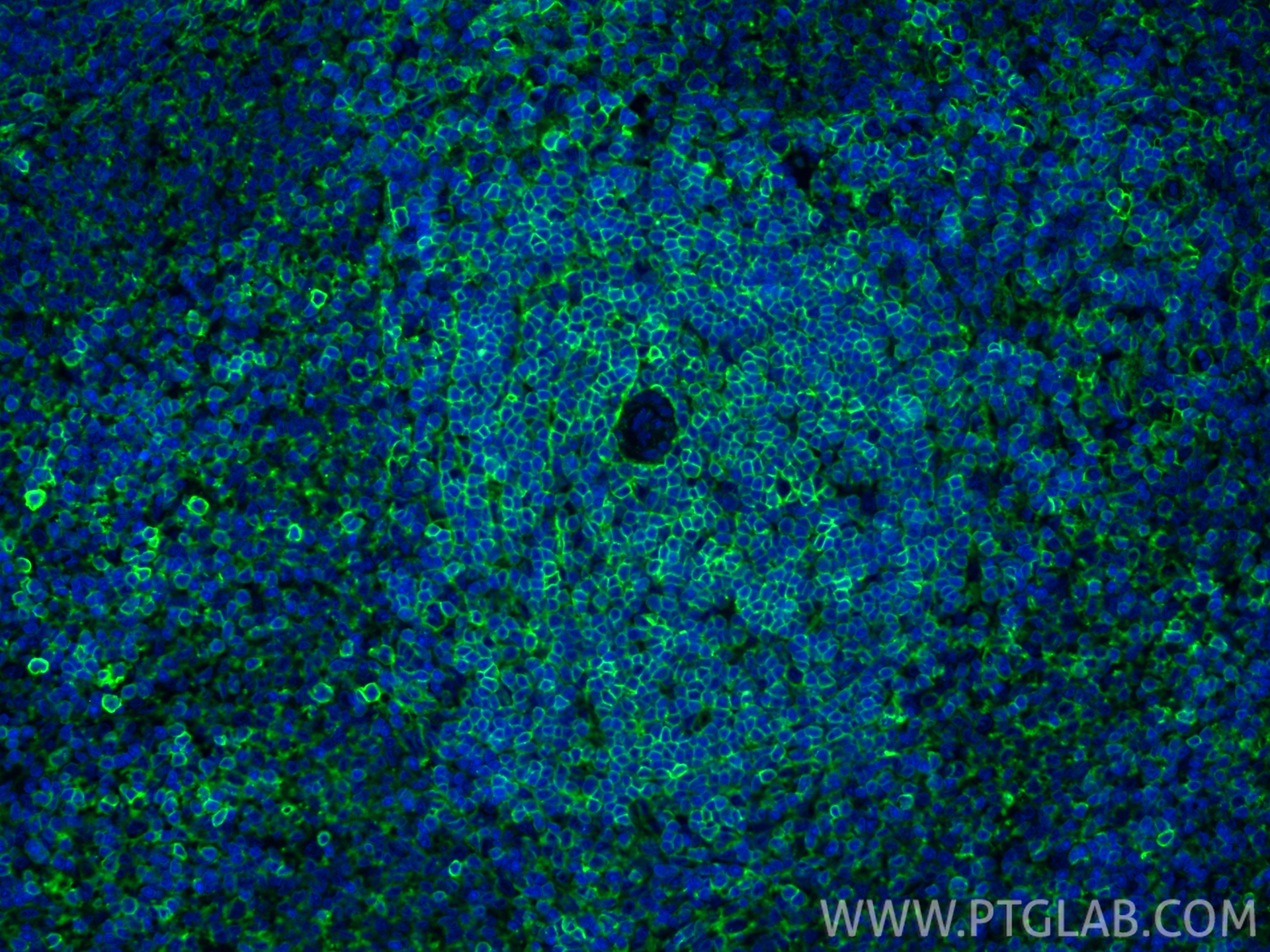 Immunofluorescent analysis of (4% PFA) fixed paraffin-embedded rat spleen tissue using CD44 antibody (31981-1-AP) at dilution of 1:200 and CoraLite®488-Conjugated Goat Anti-Rabbit IgG(H+L) (<a class='green' href='/productredirect?CatalogNo=SA00013-2' target='_blank'>SA00013-2</a>). Heat mediated antigen retrieval with Tris-EDTA buffer (pH 9.0). IF Staining of rat spleen using 31981-1-AP