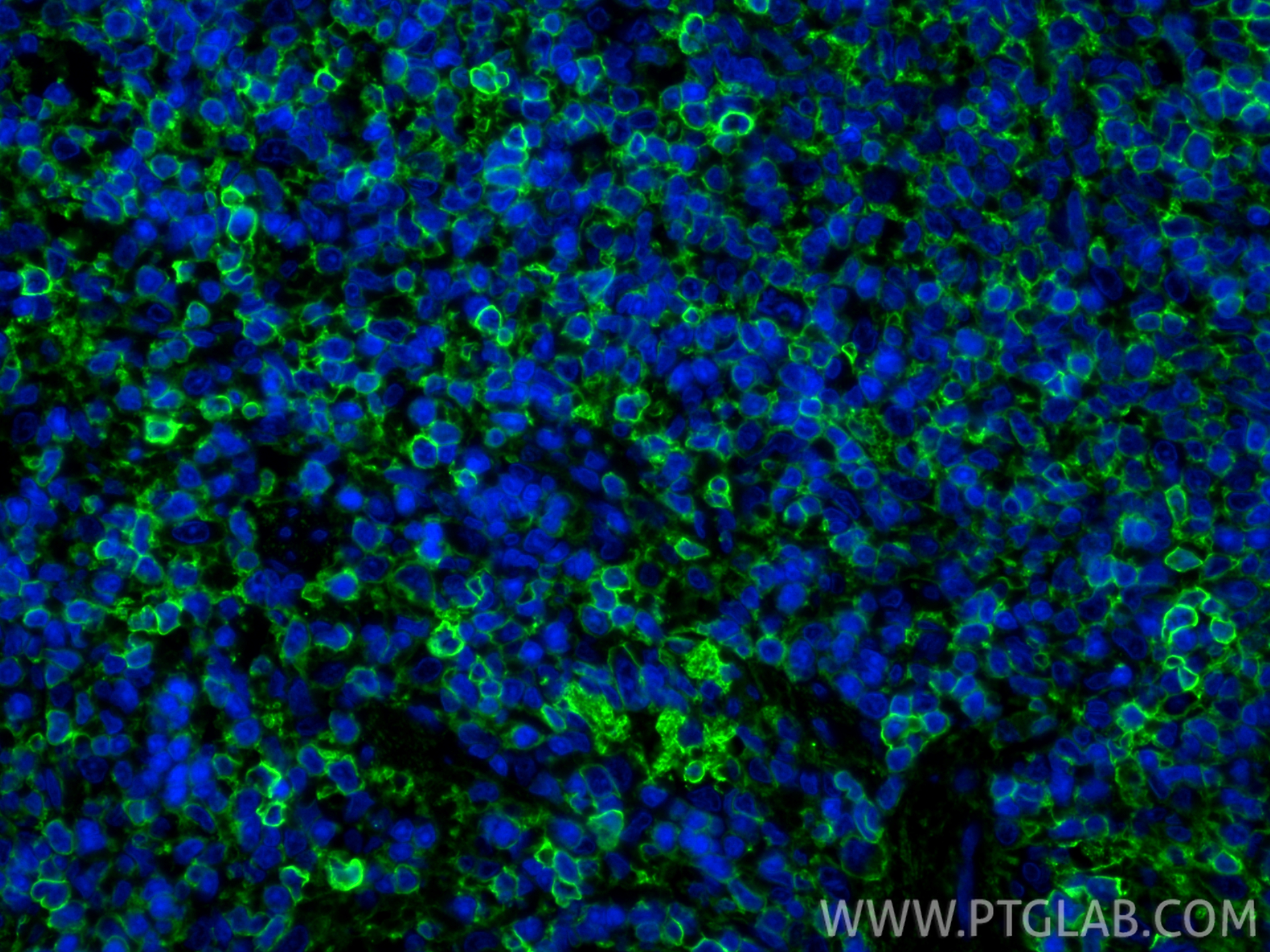 Immunofluorescent analysis of (4% PFA) fixed paraffin-embedded rat spleen tissue using CD44 antibody (31981-1-AP) at dilution of 1:200 and CoraLite®488-Conjugated Goat Anti-Rabbit IgG(H+L) (<a class='green' href='/productredirect?CatalogNo=SA00013-2' target='_blank'>SA00013-2</a>). Heat mediated antigen retrieval with Tris-EDTA buffer (pH 9.0). IF Staining of rat spleen using 31981-1-AP