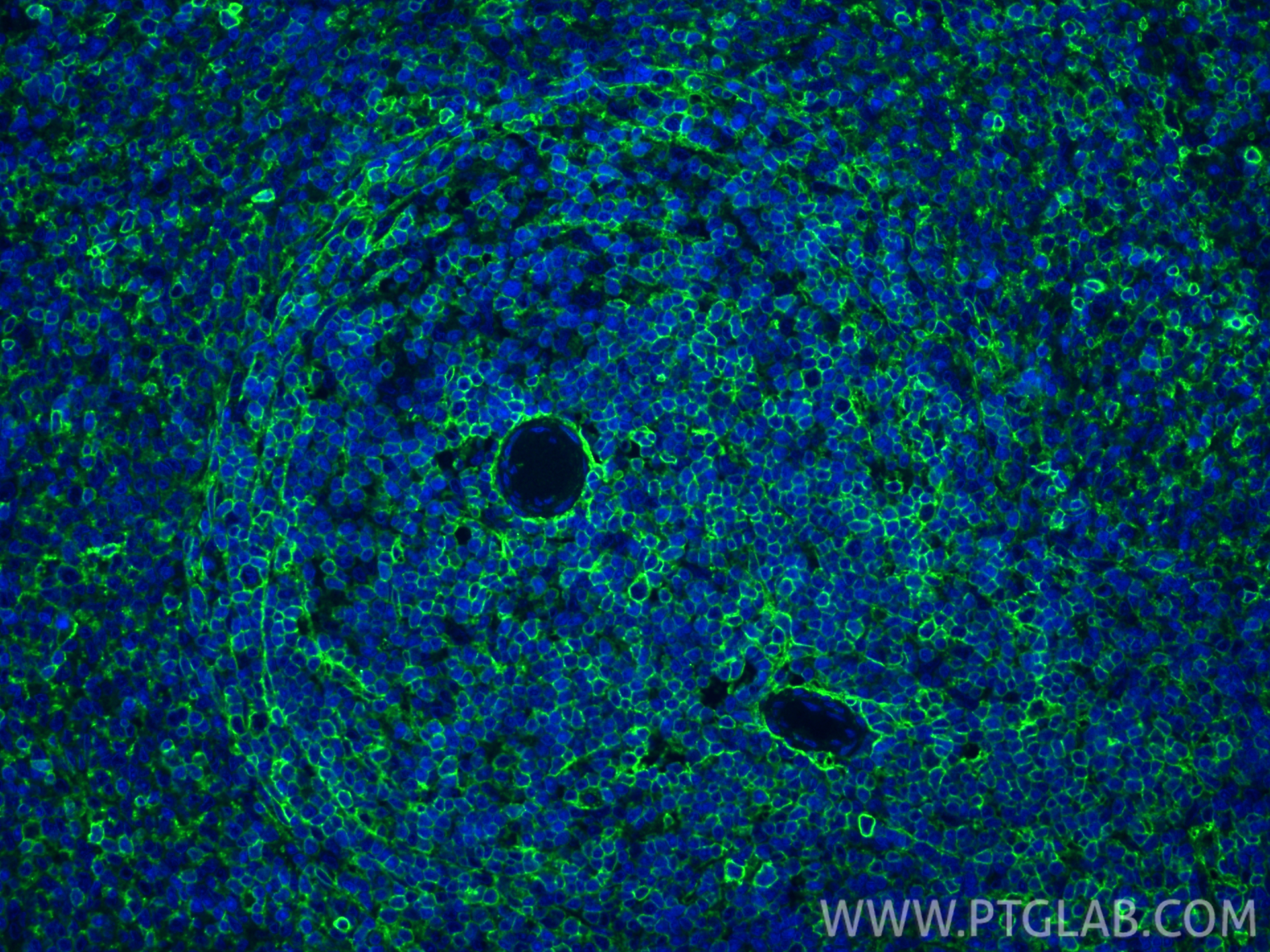 IF Staining of rat spleen using 84369-5-RR