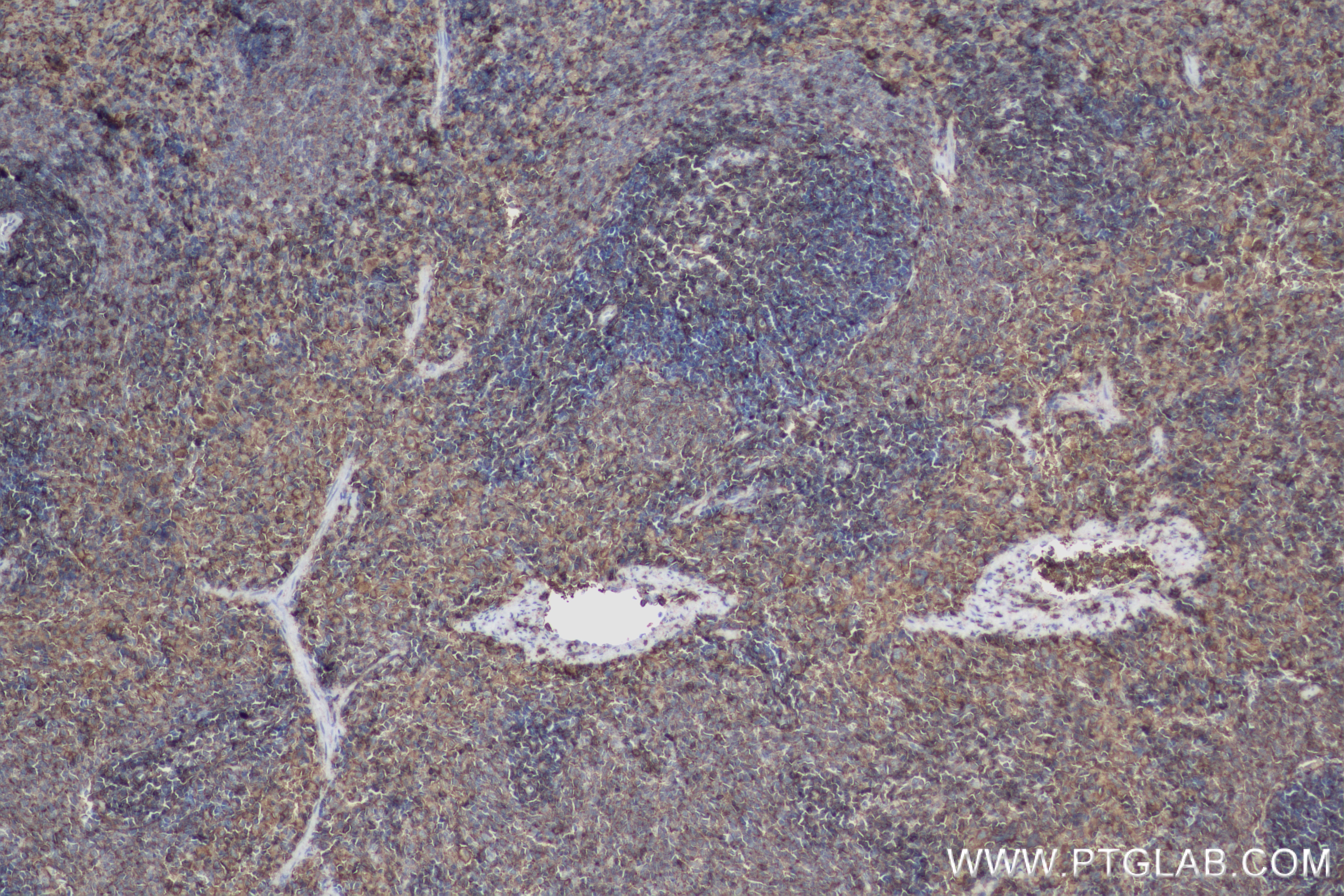 IHC staining of rat spleen using 84369-5-RR