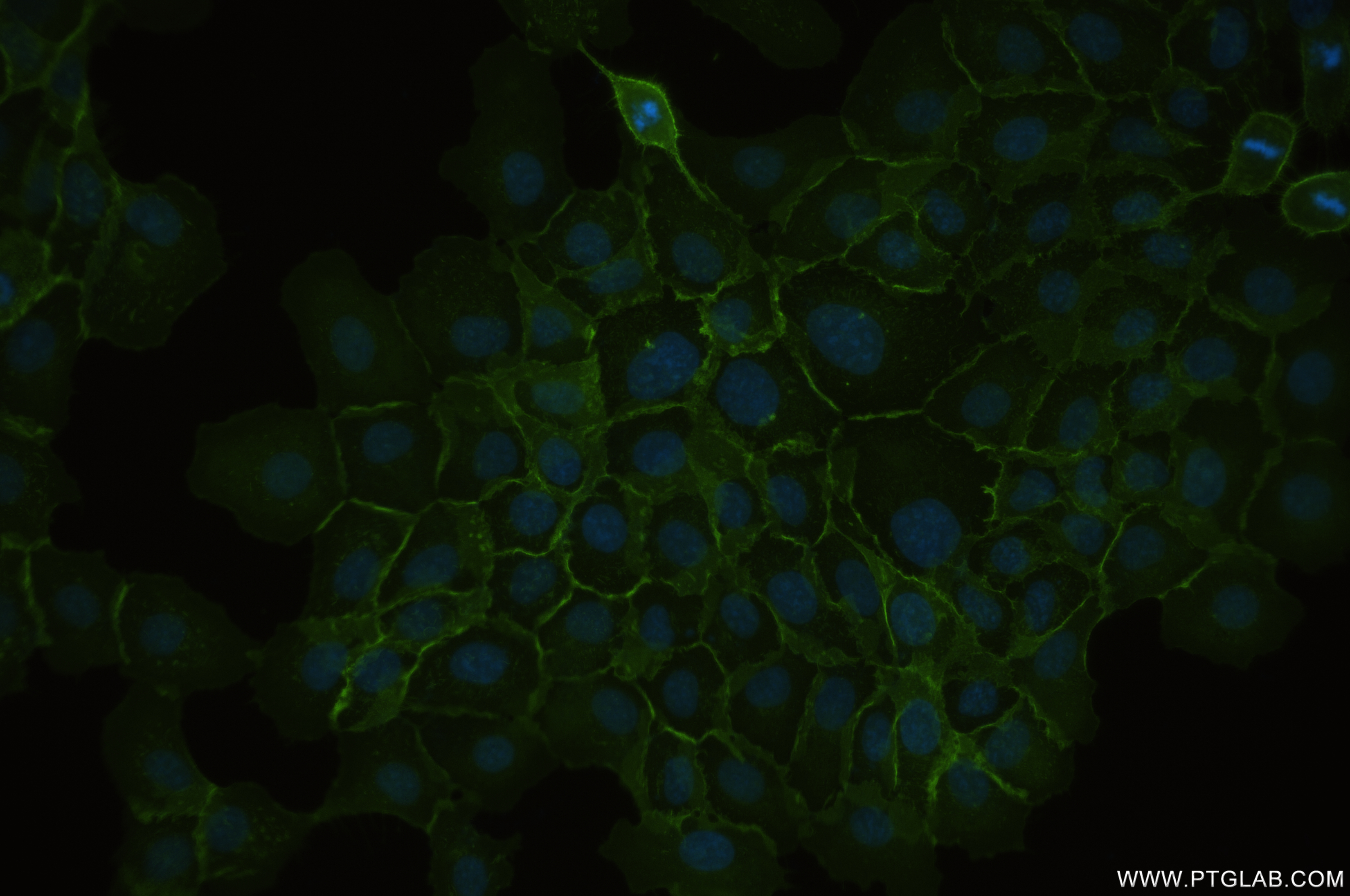 IF Staining of A431 using 84854-5-RR (same clone as 84854-5-PBS)