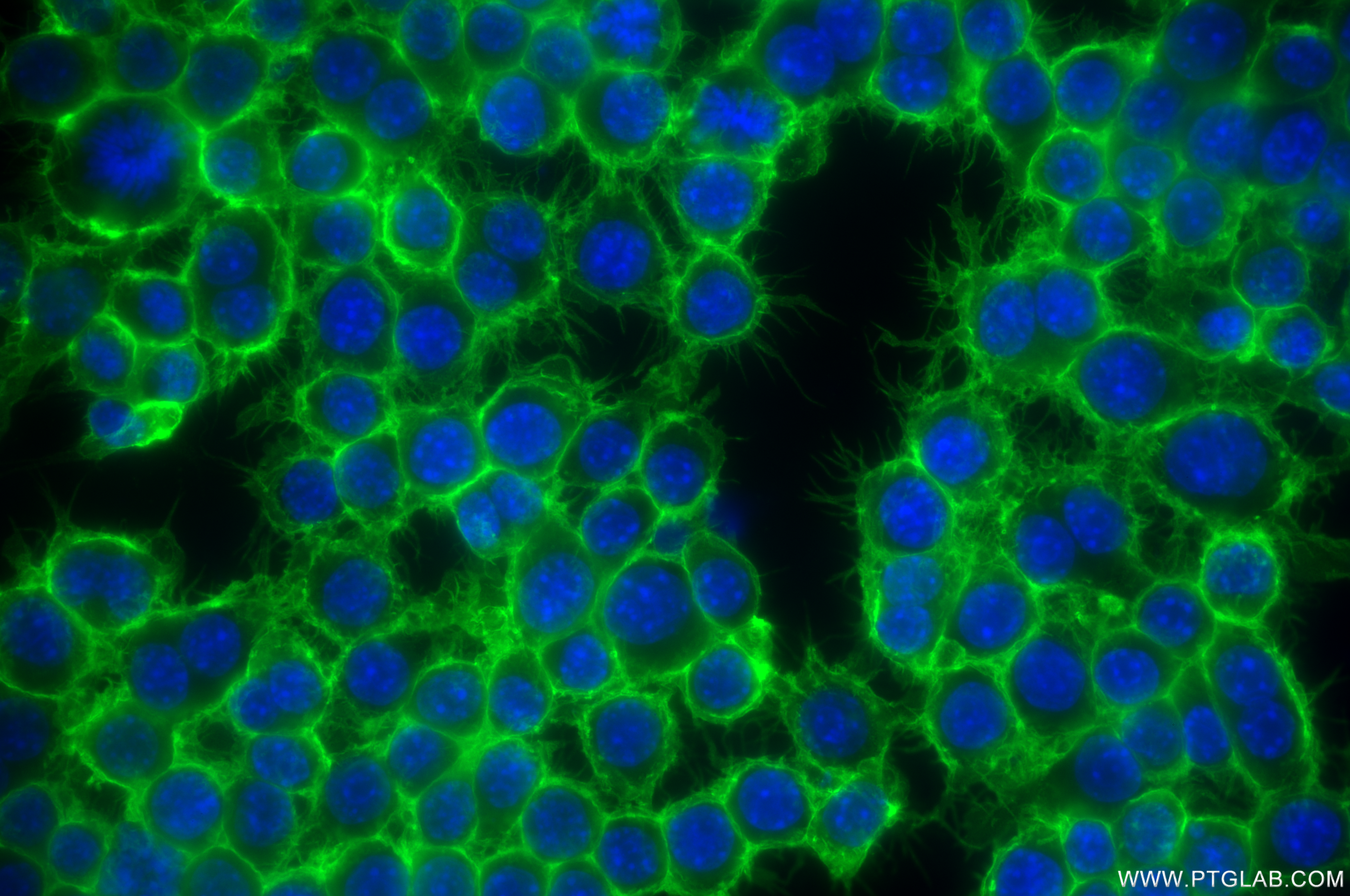 IF Staining of RAW 264.7 using 85163-5-RR